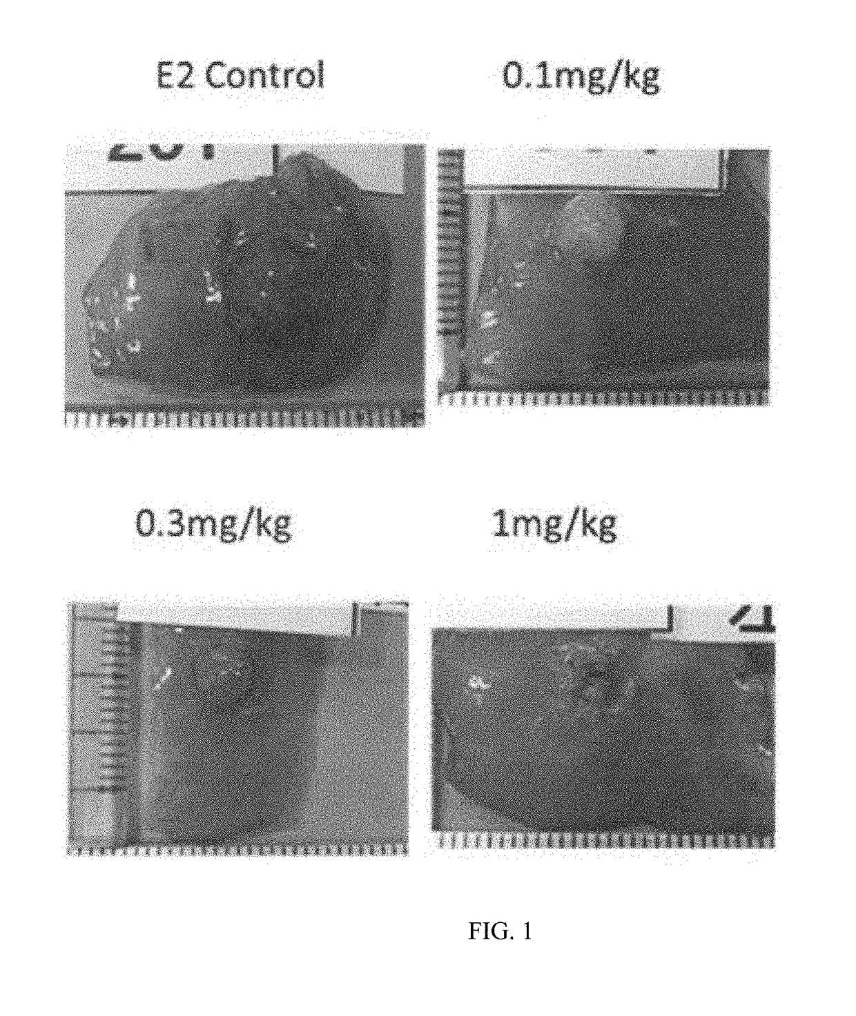 ESTROGEN RECEPTOR Beta PARTIAL AGONIST HAVING ESTROGEN RECEPTOR Alpha INHIBITORY EFFECT, AND GYNECOLOGICAL DISEASE THERAPEUTIC AGENT USING SAME