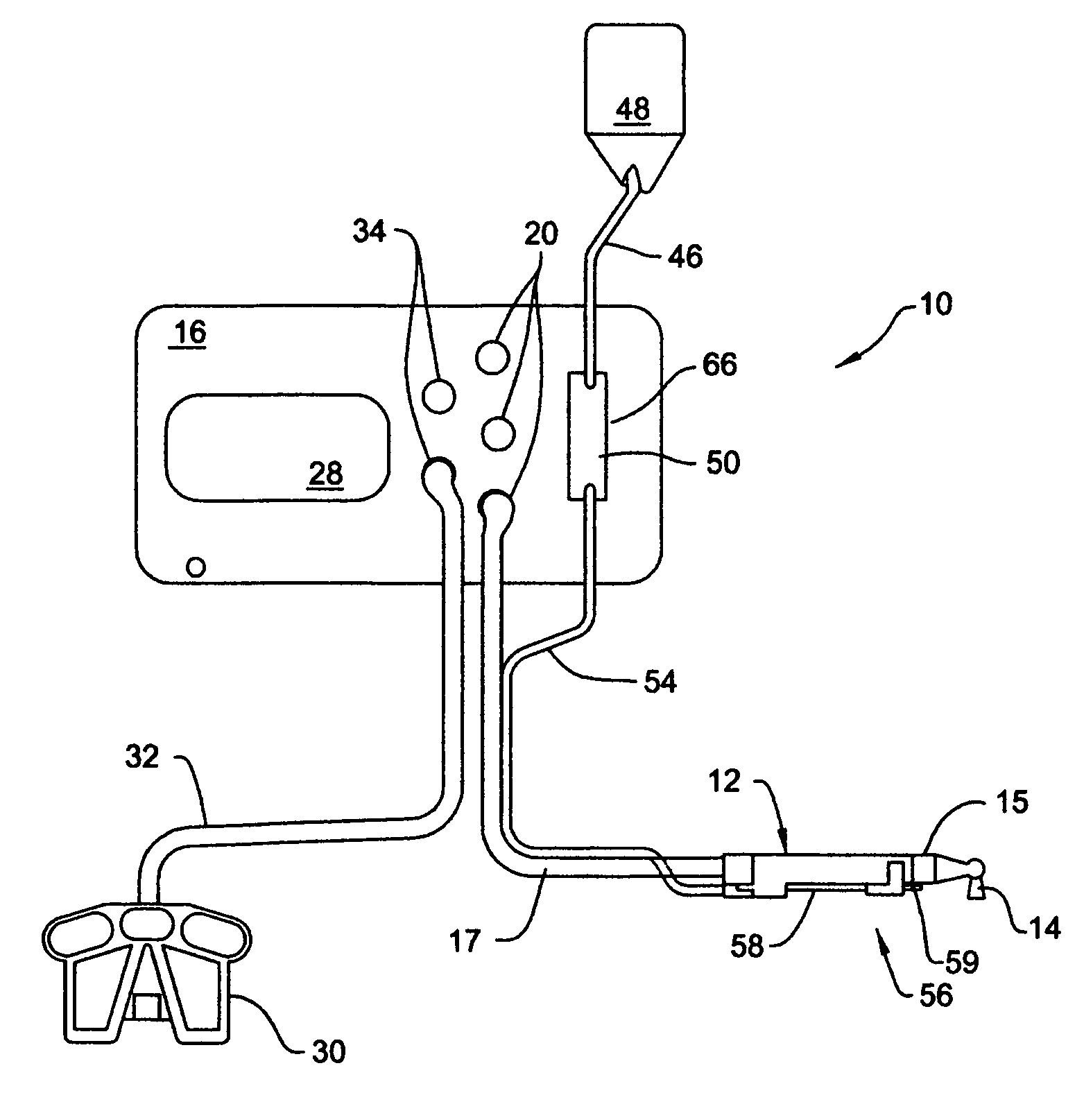 Method of operating a surgical irrigation pump capable of performing a priming operation