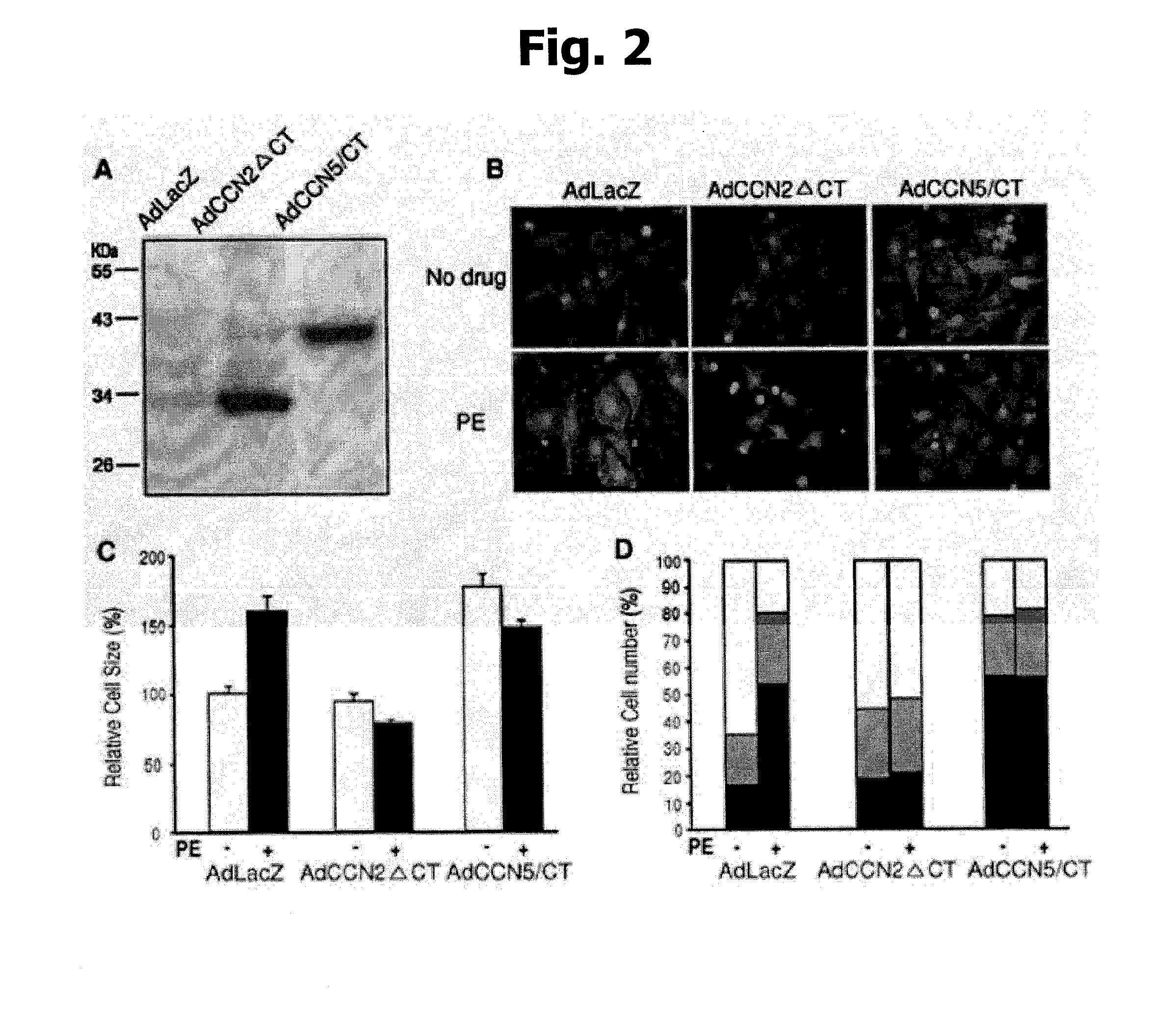 Pharmaceutical composition for preventing or treating heart failure and method for screening agent for preventing or treating heart failure