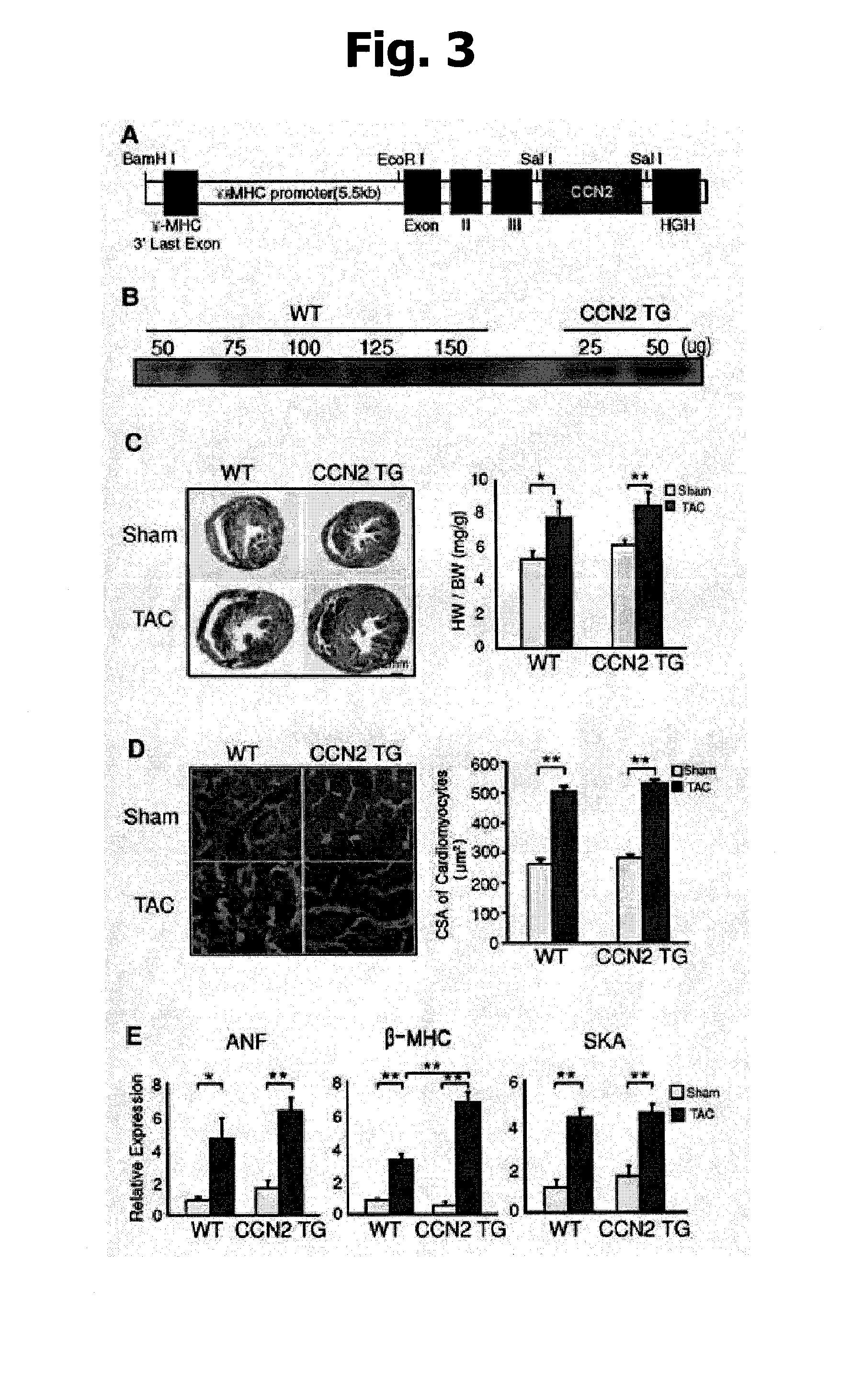 Pharmaceutical composition for preventing or treating heart failure and method for screening agent for preventing or treating heart failure