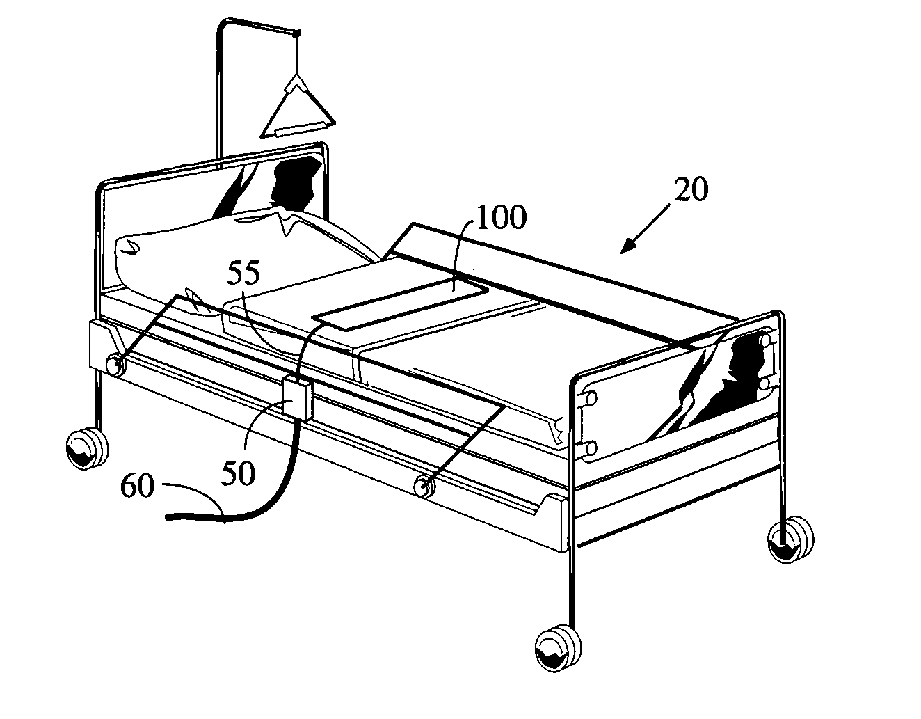 Sensor and method for detecting a patient's movement via position and occlusion