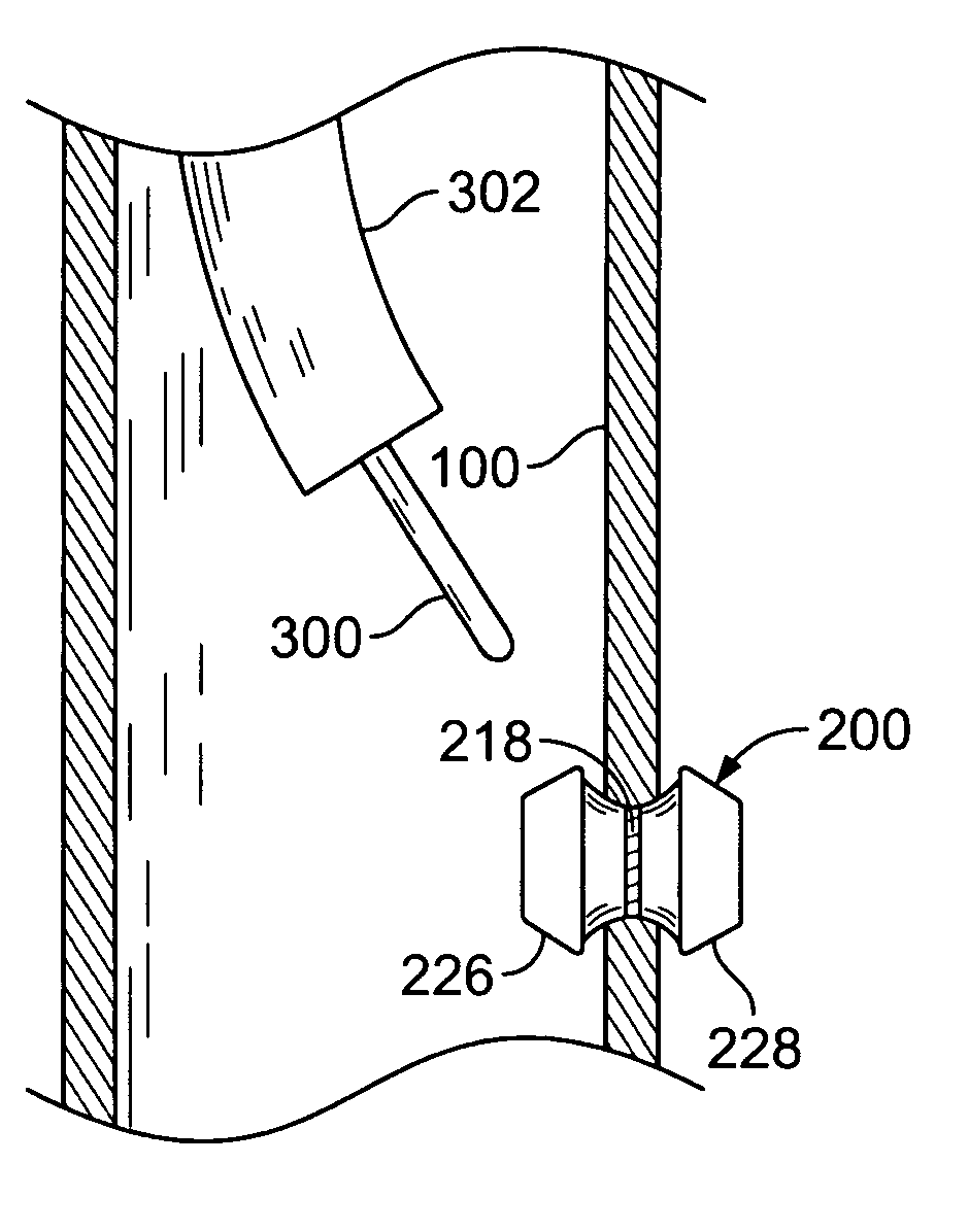 Methods and devices for maintaining patency of surgically created channels in a body organ