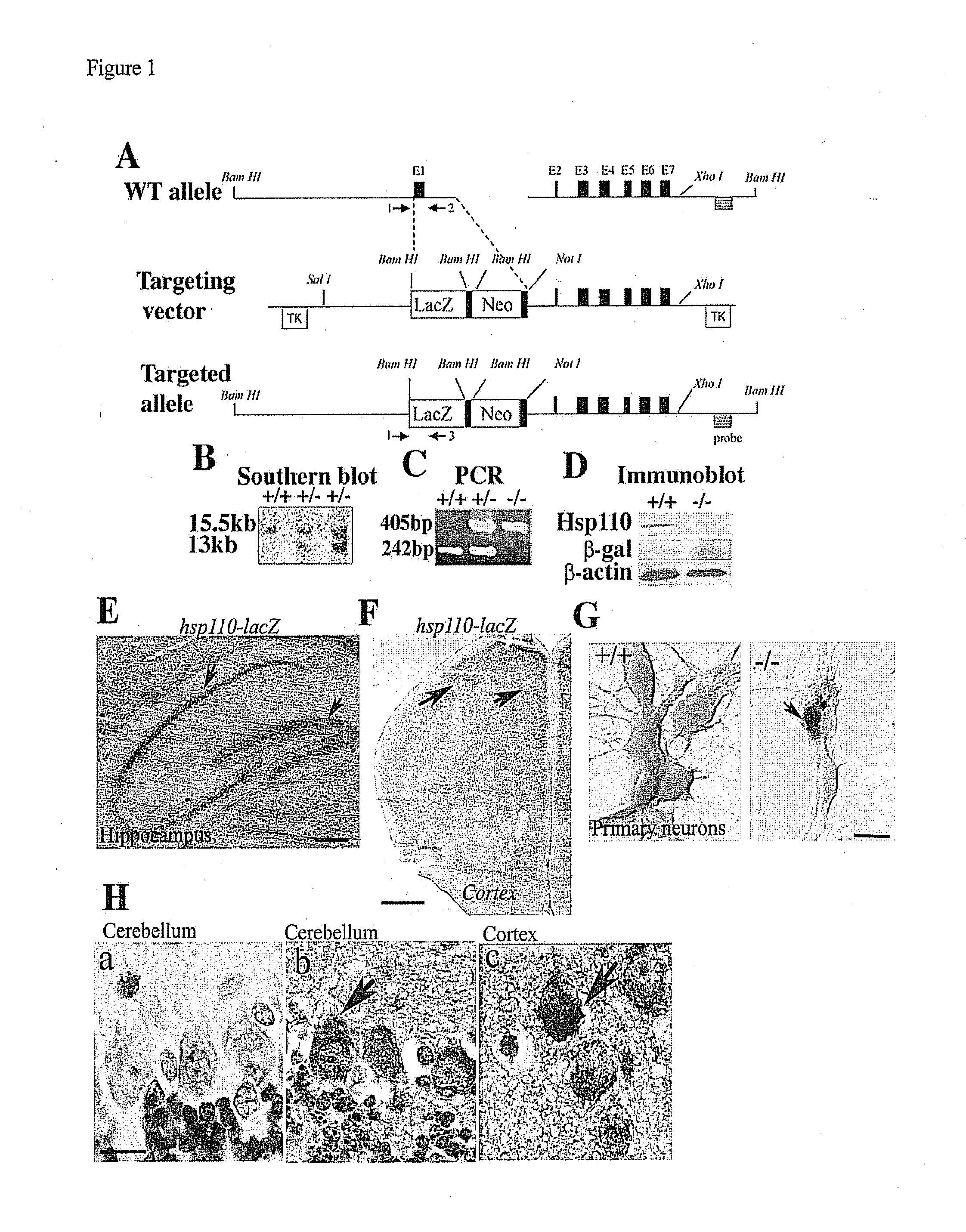 Heat shock protein deficiencies as model systems for brain pathology and cancer