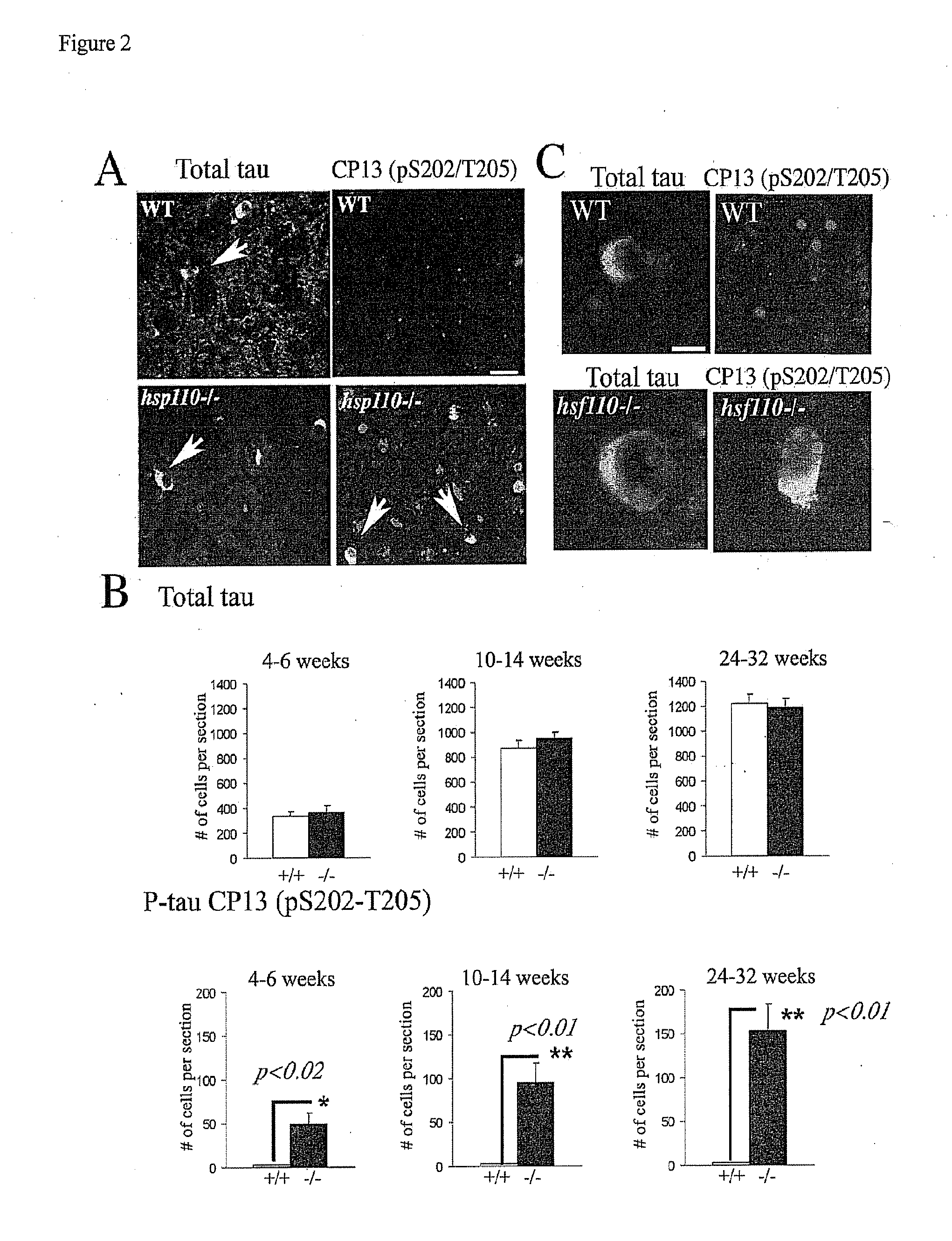 Heat shock protein deficiencies as model systems for brain pathology and cancer