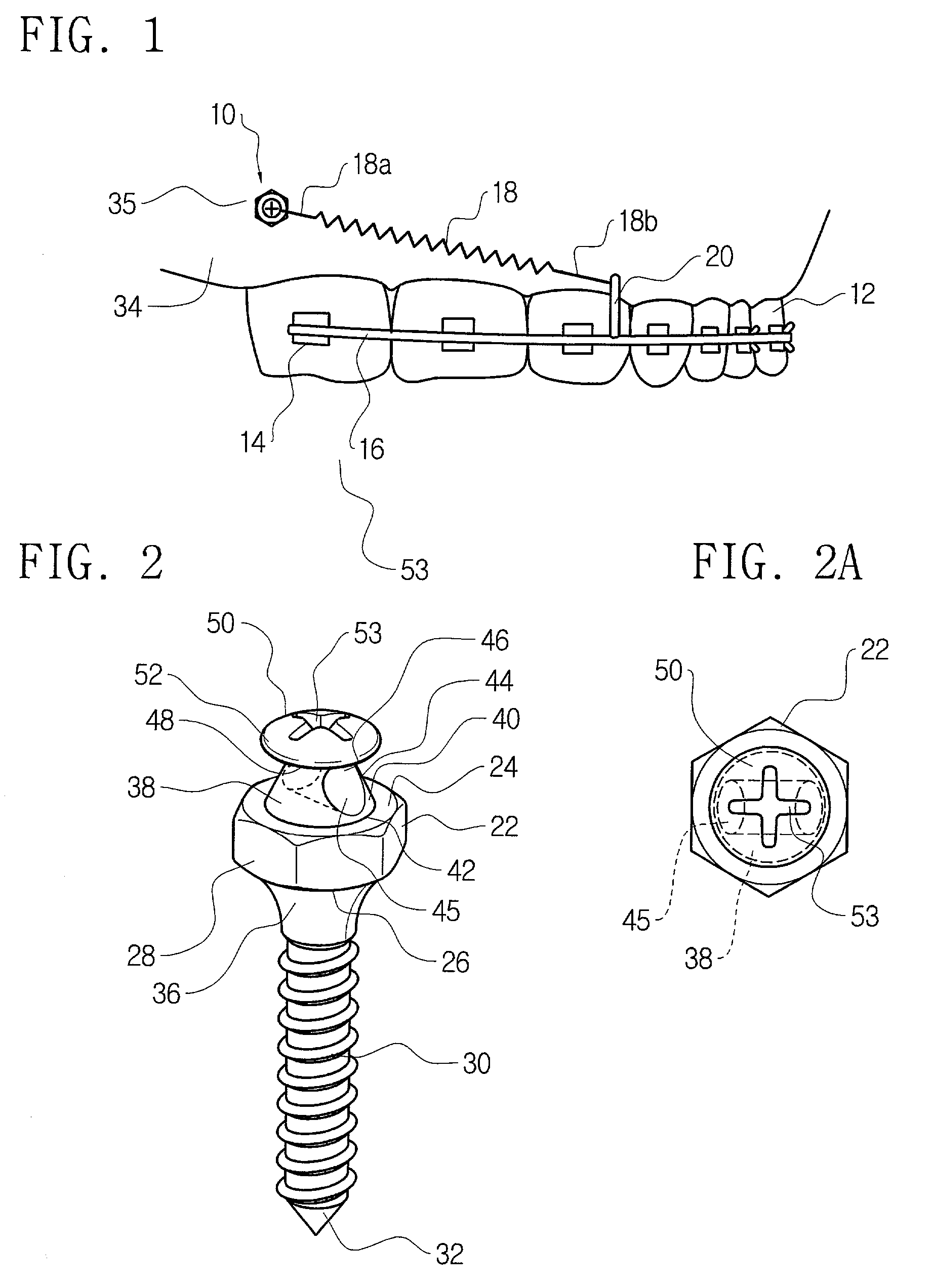 Osteogenic support device for orthodontic treatment