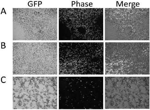 Method for realizing hematological reconstruction by virtue of IBMI of fetal liver Ficoll separated unicell suspension