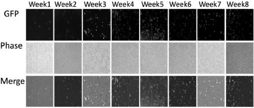 Method for realizing hematological reconstruction by virtue of IBMI of fetal liver Ficoll separated unicell suspension