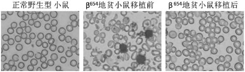 Method for realizing hematological reconstruction by virtue of IBMI of fetal liver Ficoll separated unicell suspension