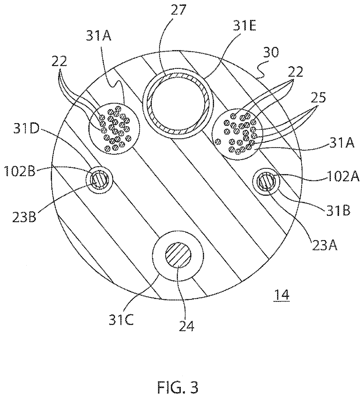 Catheter with electrode spine assembly having preformed configurations for improved tissue contact