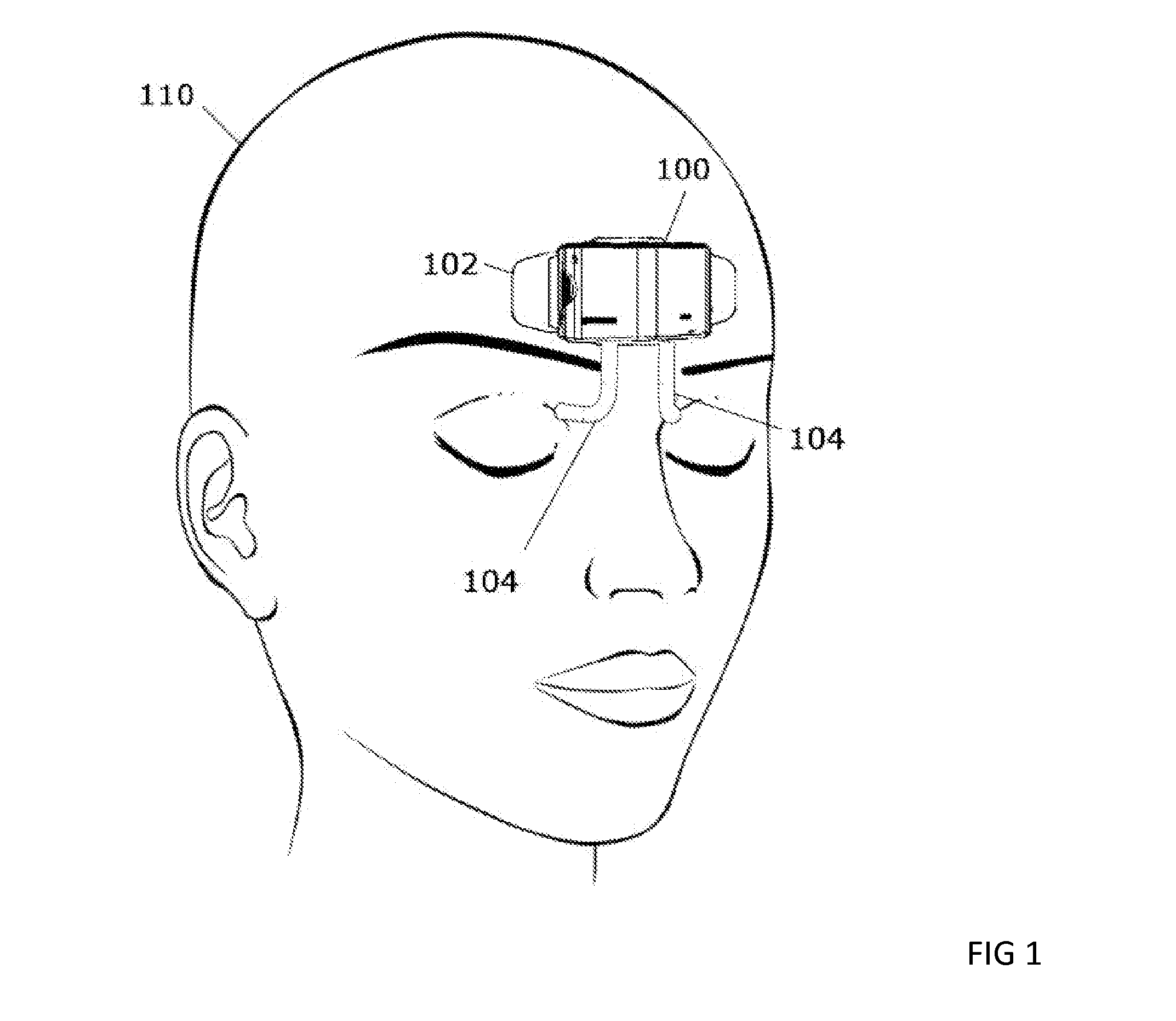 Forehead-wearable light stimulator having one or more light pipes