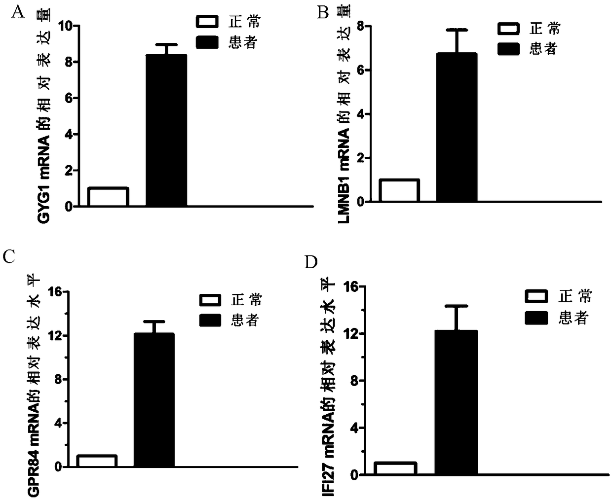 Biological marker for diagnosing respiratory virus infection of children