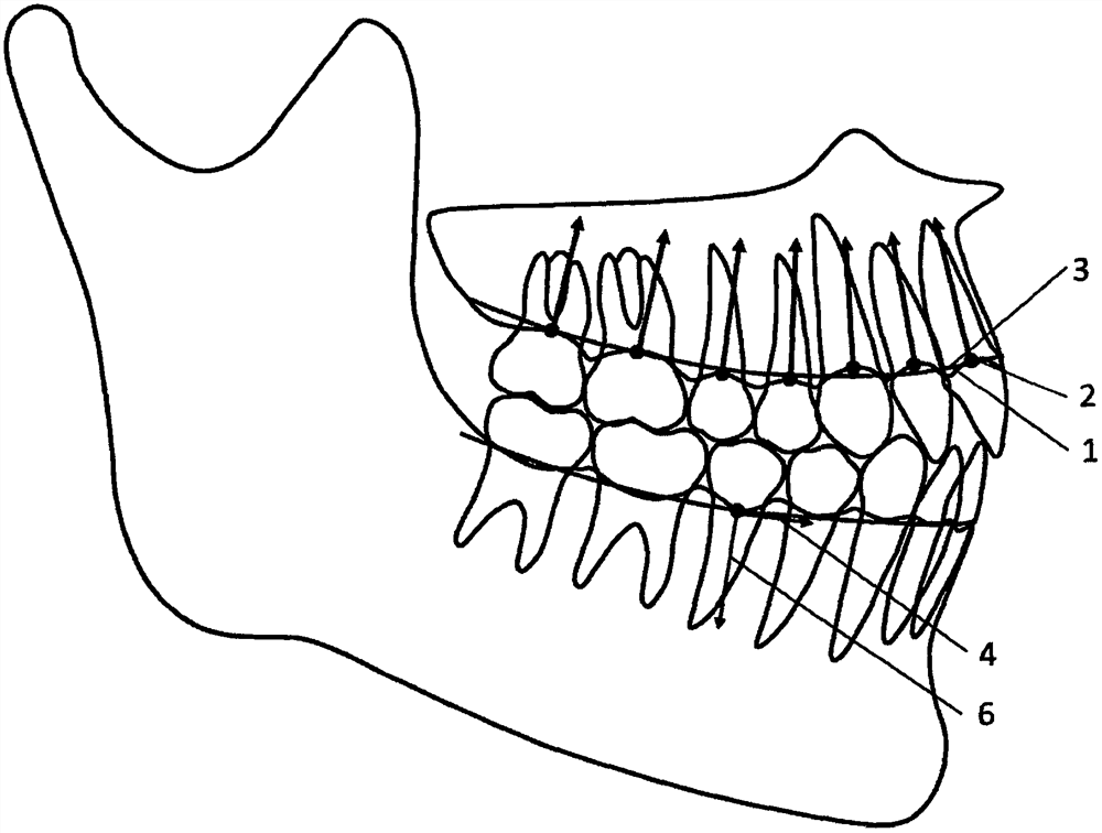 Tooth movement evaluation method under curve natural coordinate system based on alveolar bone form