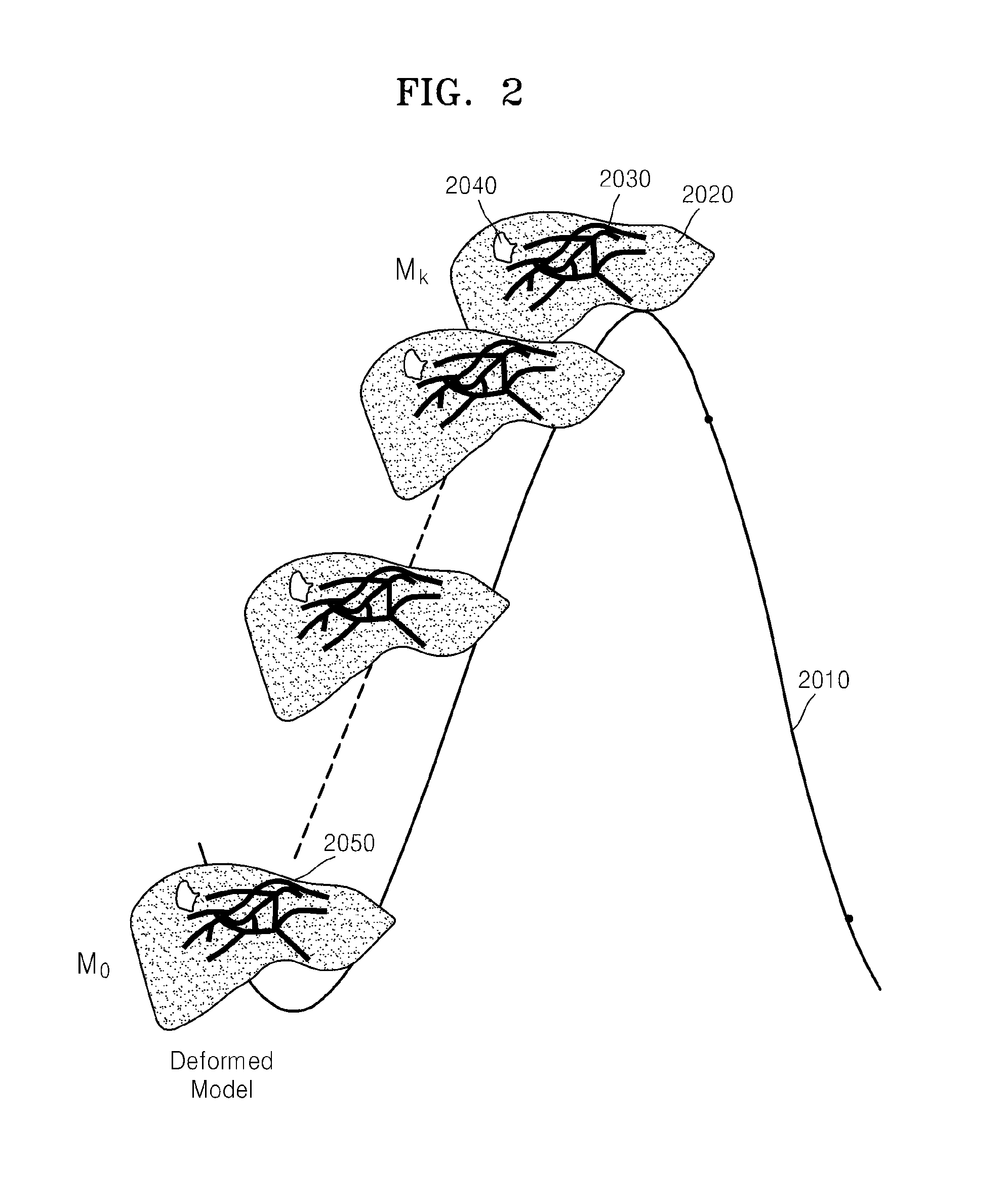 Method, apparatus, and system for tracking deformation of organ during respiration cycle