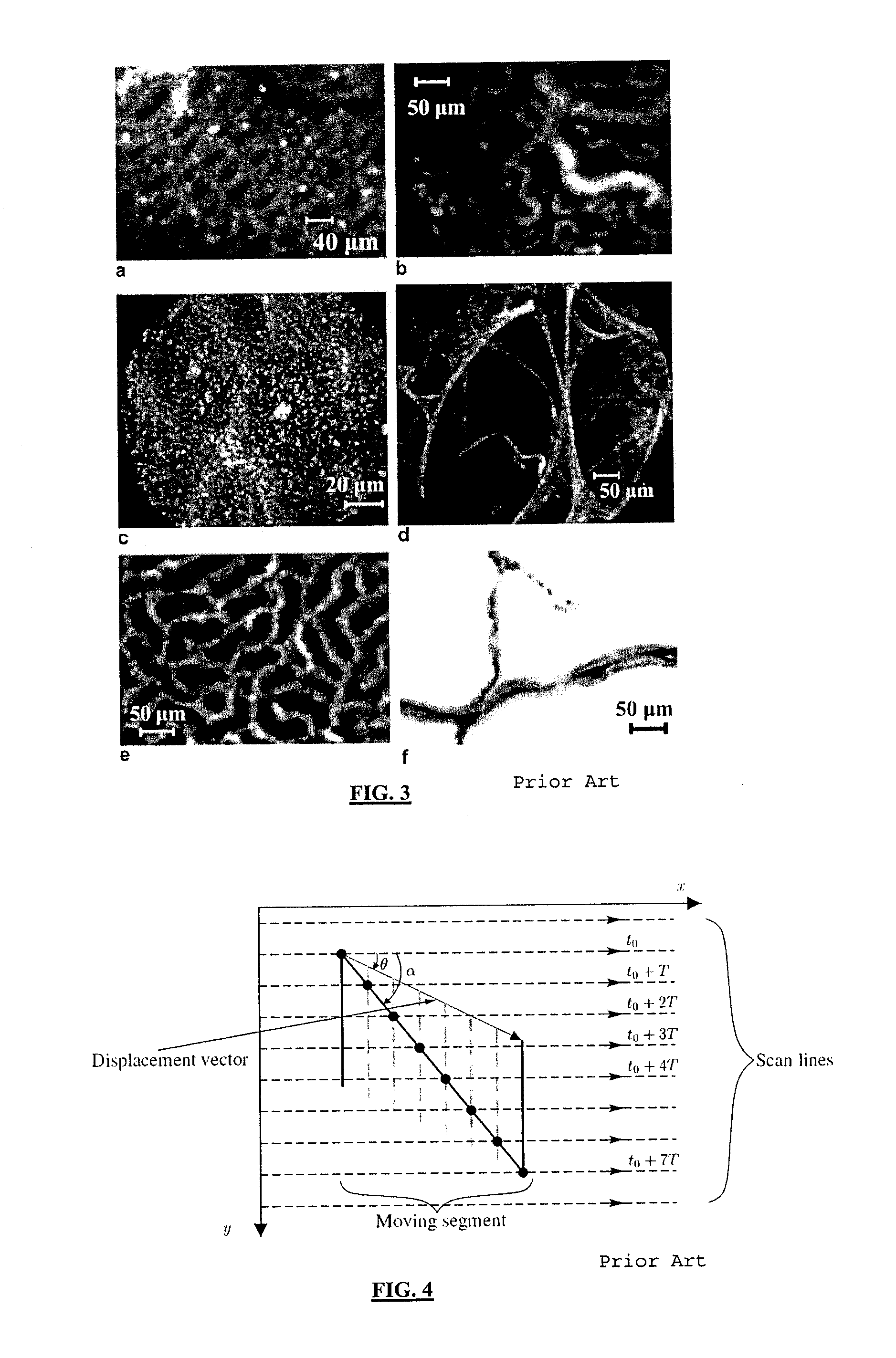 Robust mosaicing method, notably with correction of motion distortions and tissue deformations for a vivo fibered microscopy