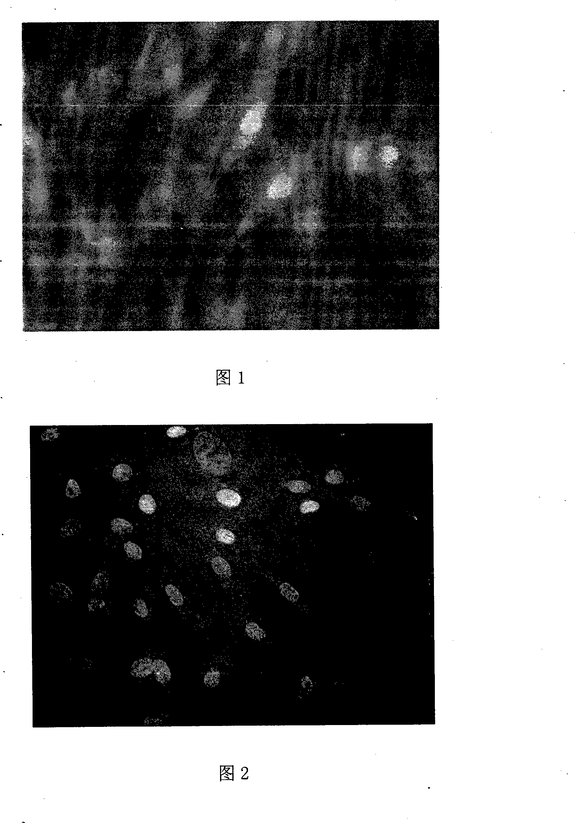 Method of preparing  containing endothelium ancestor cell preparation utilizing umbilical or placenta and uses thereof