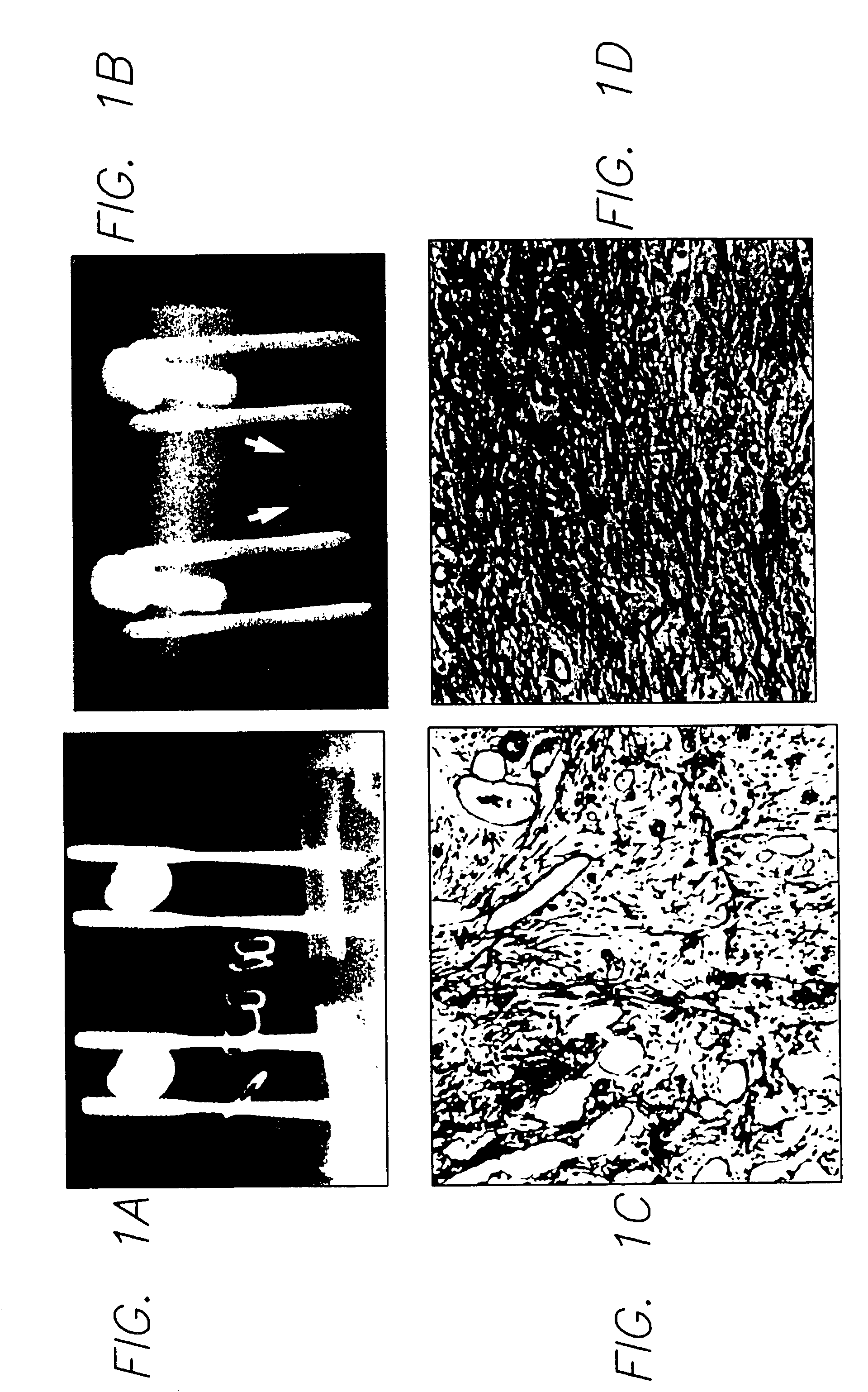 In vivo gene transfer methods for wound healing