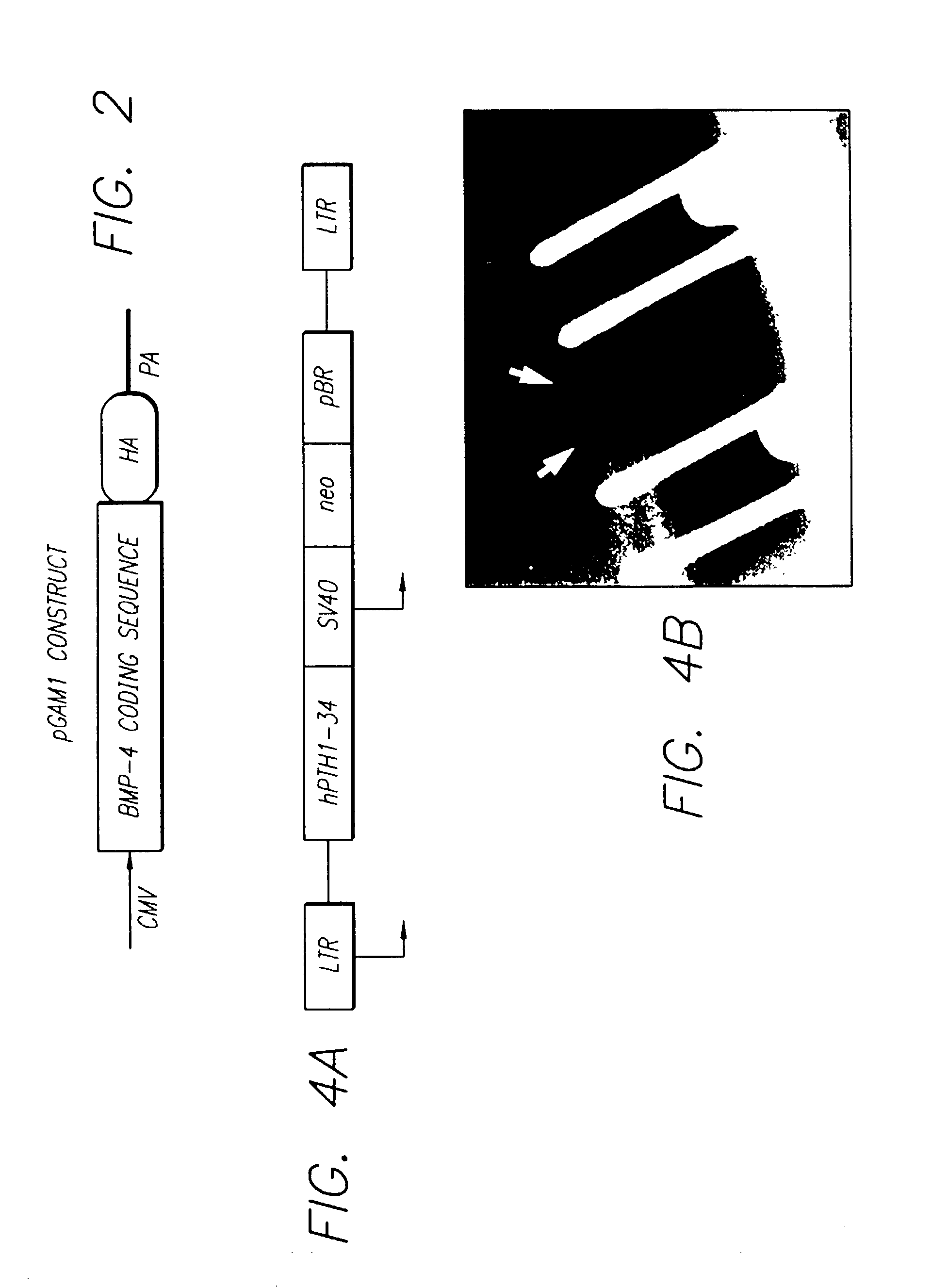 In vivo gene transfer methods for wound healing