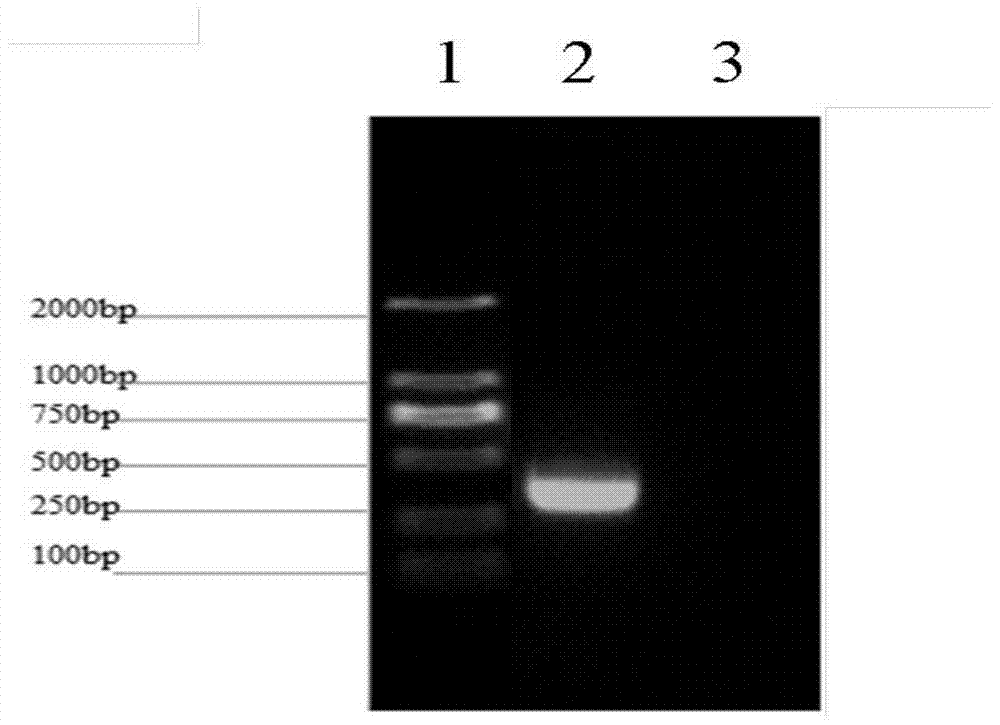 A kind of porcine igfn1 protein polyclonal antibody and its preparation method and application