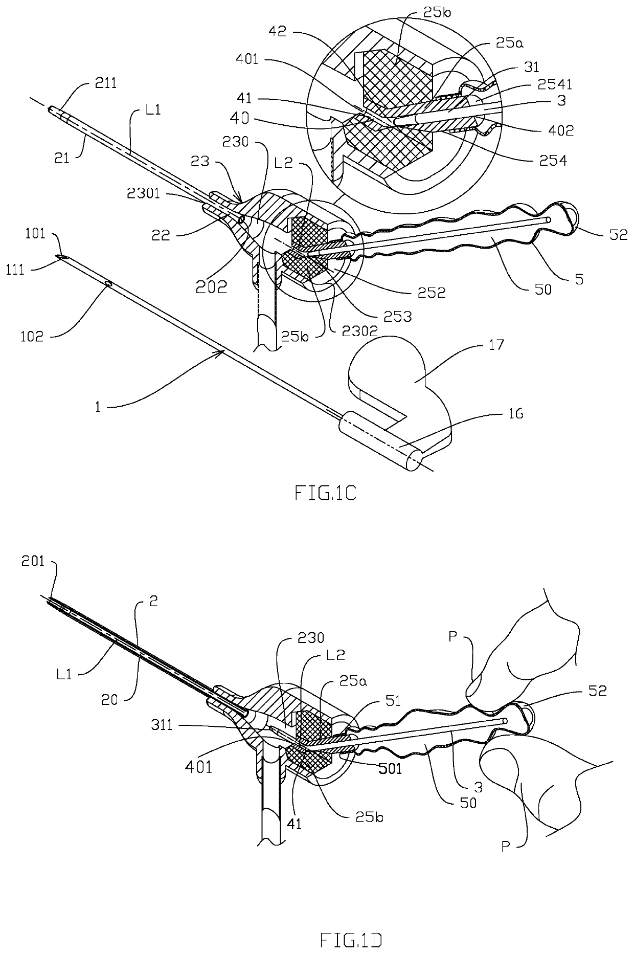 Venous Catheter Device Capable of Being Sealed