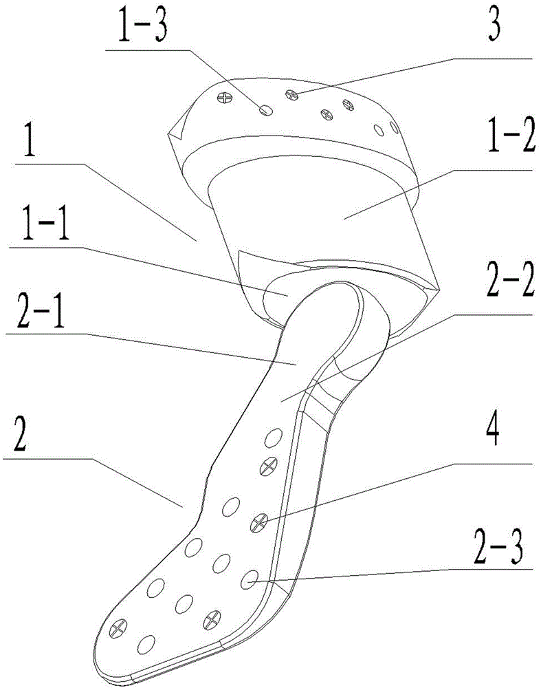Temporomandibular joint fovea prosthesis