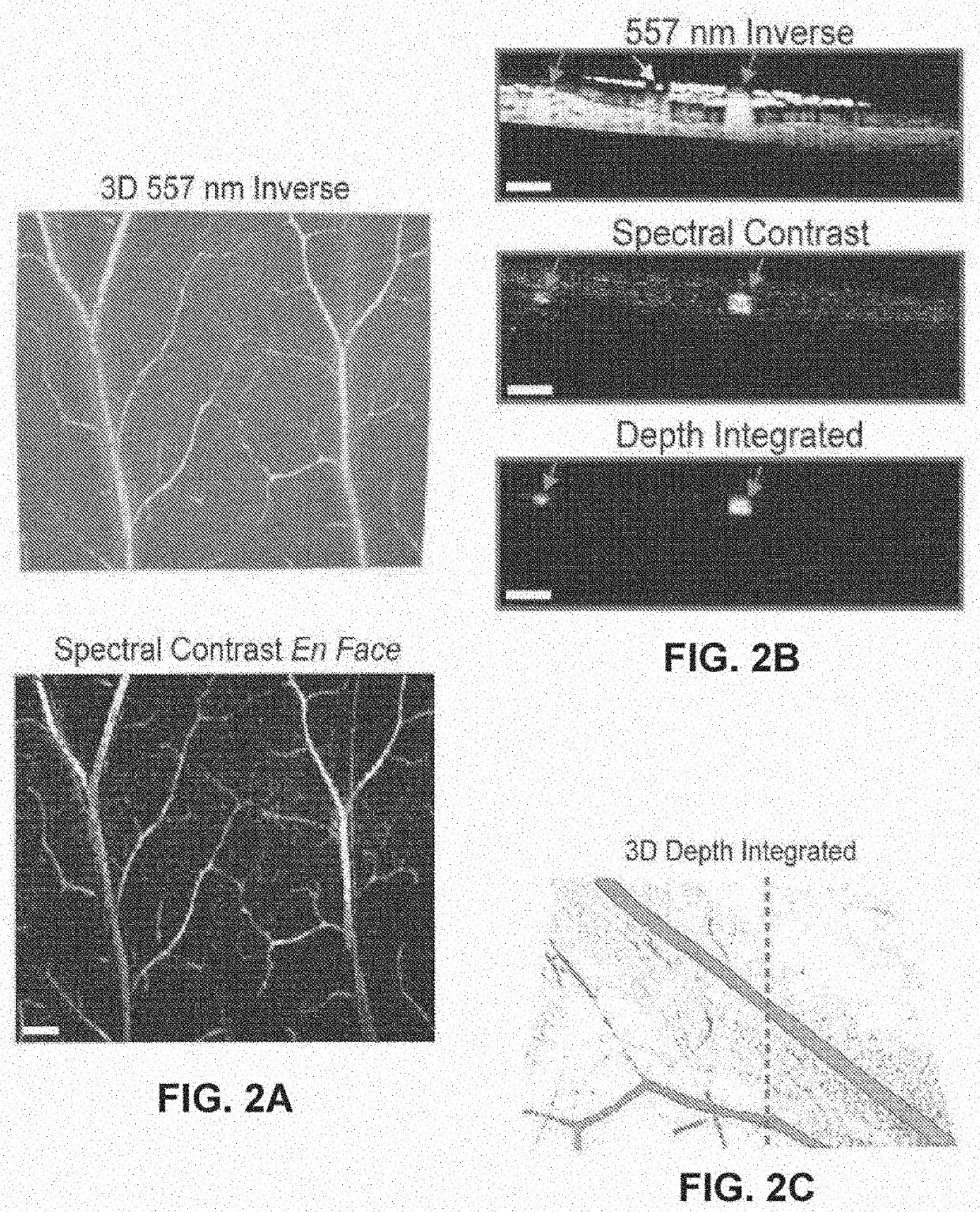 Spectral contrast optical coherence tomography angiography