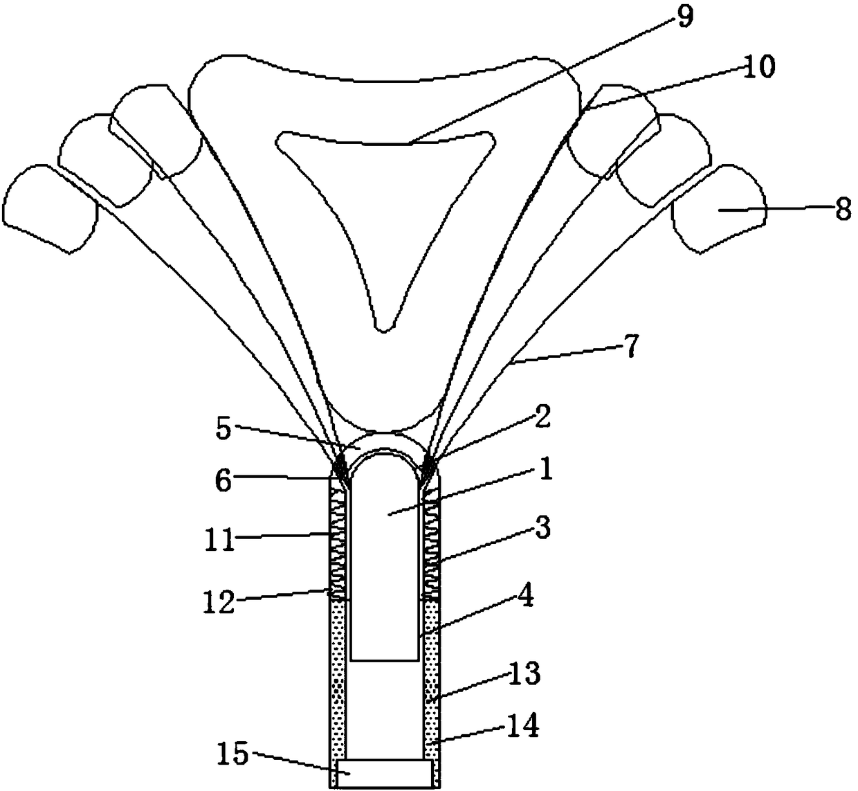 An adjustable intrauterine device