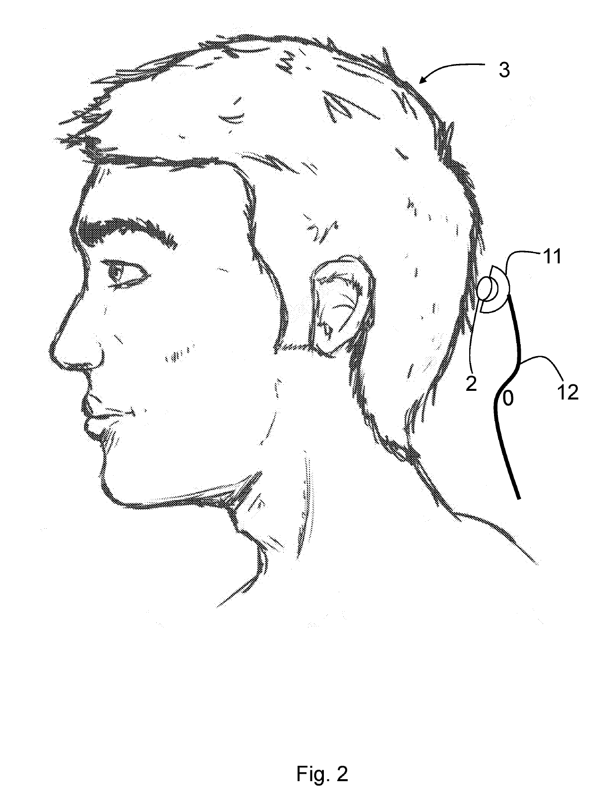 Detection system of electroencephalographic signals