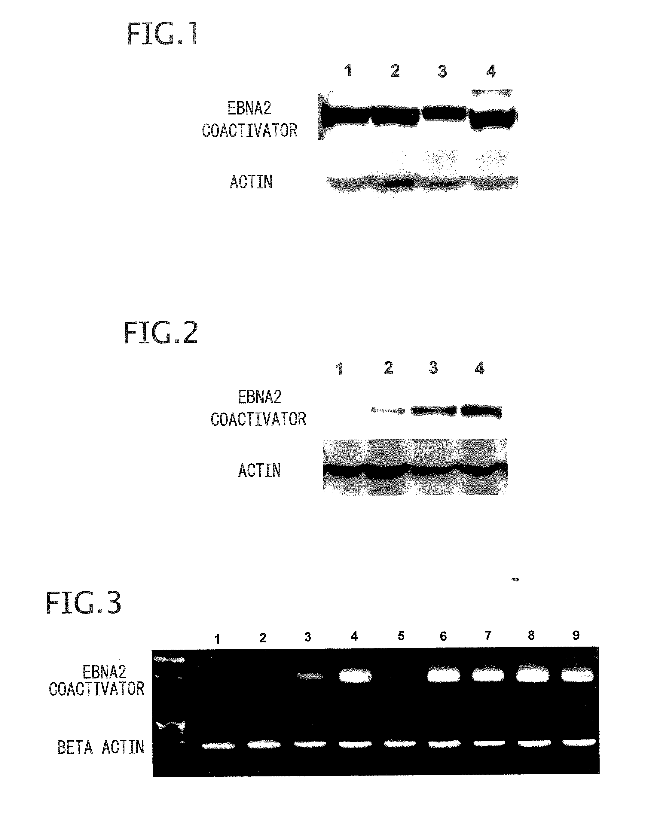 Method and composition for detecting cancer by means of detection of epstein-barr virus nuclear antigen 2 coactivator p100