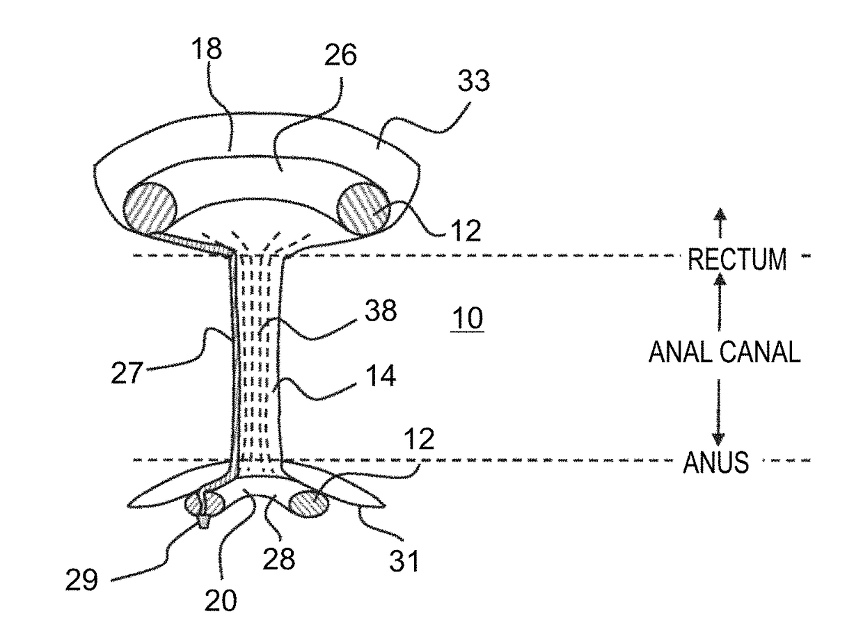 Device for protecting hemorrhoids