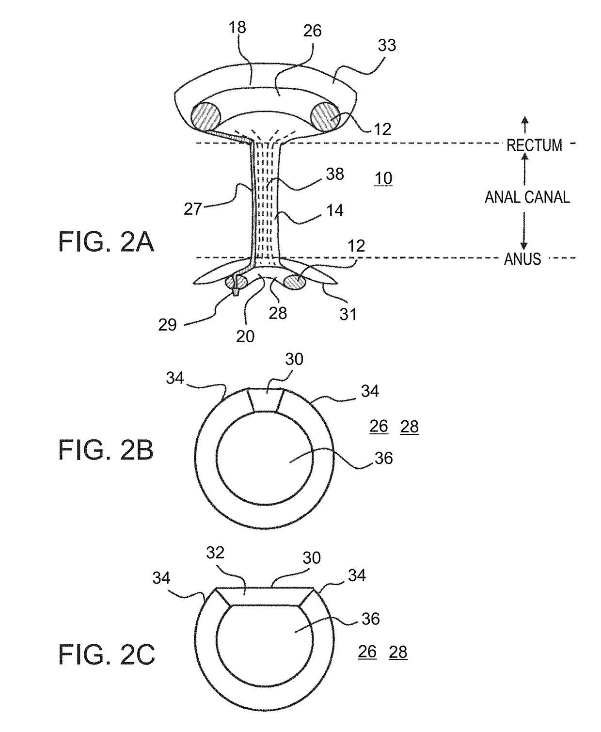 Device for protecting hemorrhoids