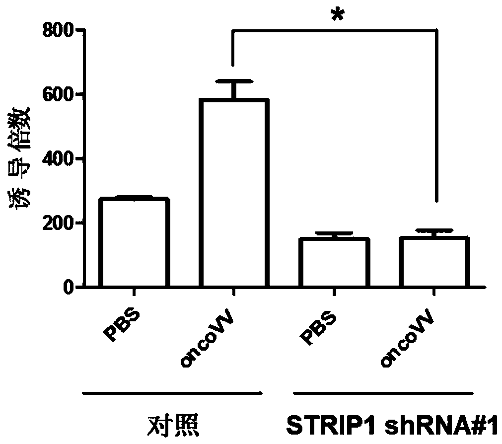 Striatin interacting protein inhibitor and application of inhibitor to preparation of anti-tumor drug