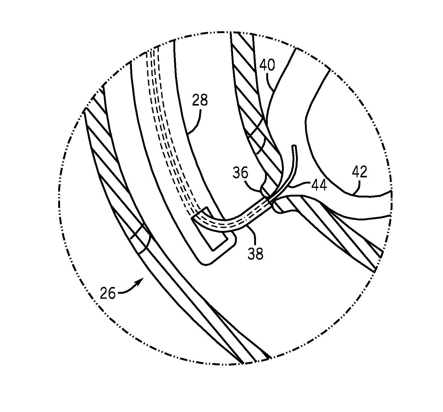 Methods and apparatuses for endoscopic retrograde cholangiopancreatography