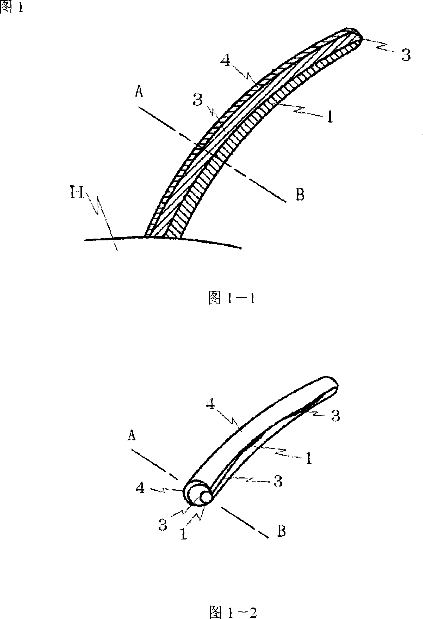 Method of hair restoration, method of fixation and stabilization of hair foundation agent, and hair restoration setting agent used in the methods