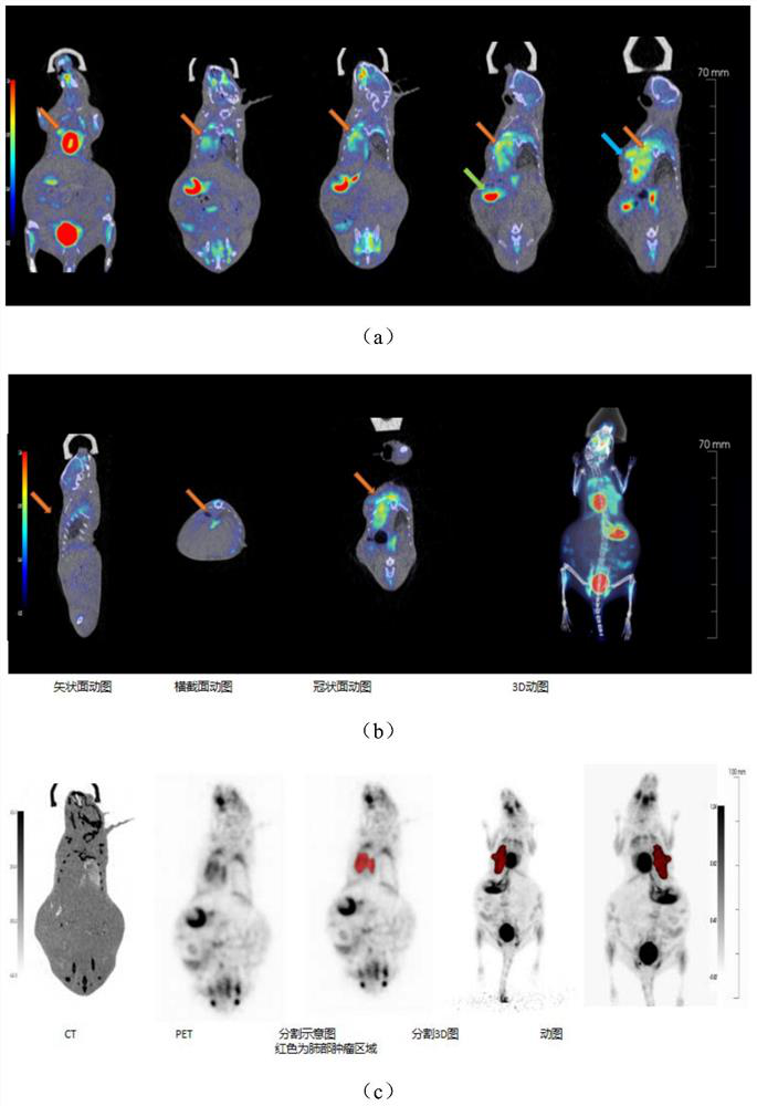 Method for constructing lung cancer in-situ PDX model through percutaneous puncture inoculation