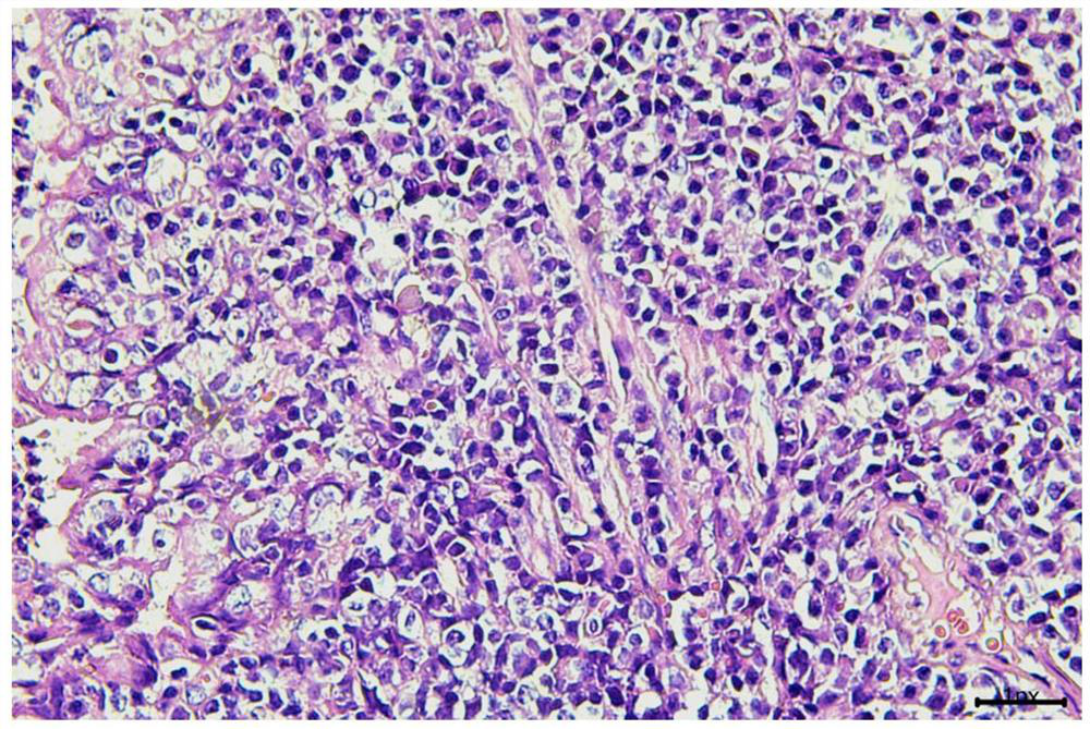 Method for constructing lung cancer in-situ PDX model through percutaneous puncture inoculation