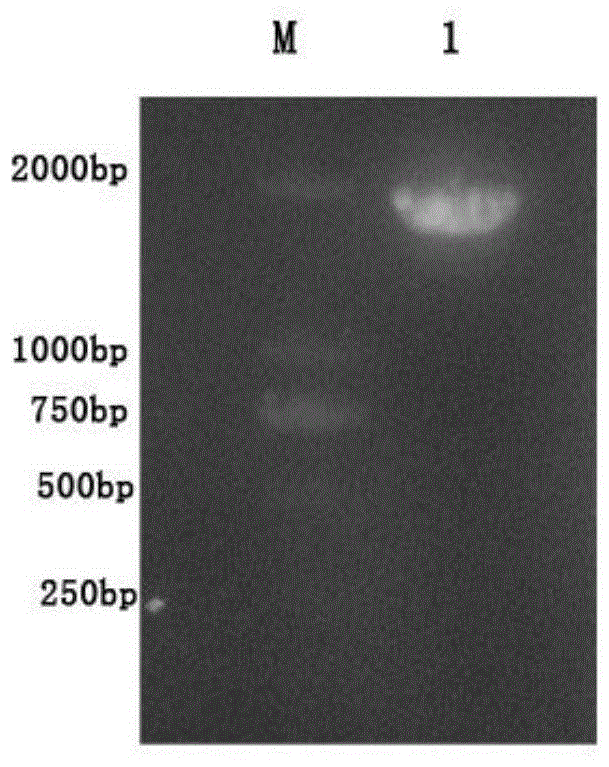 A glutamic acid decarboxylase recombinant plasmid and its construction method and application