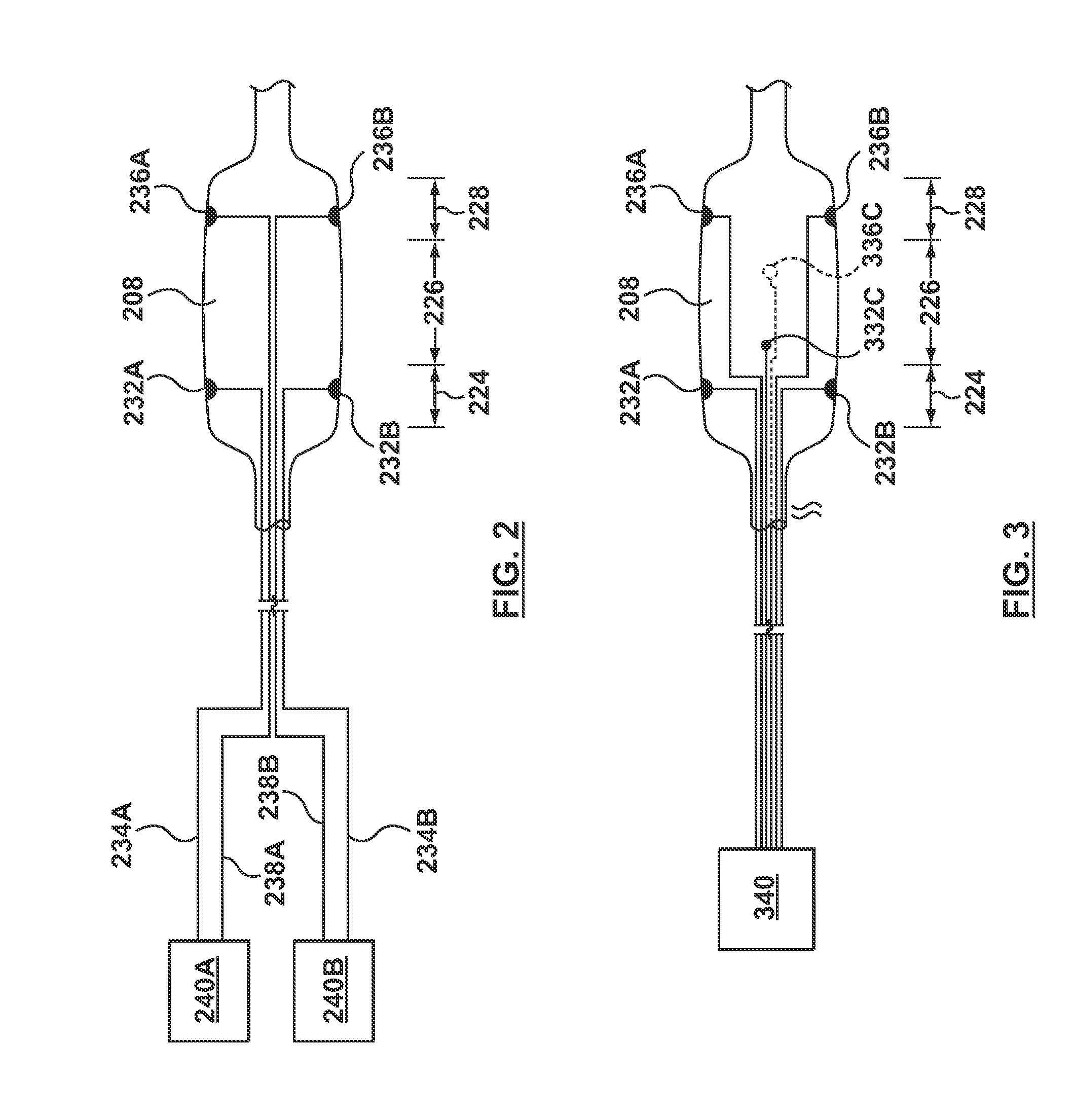 Stent Delivery System for Detecting Wall Apposition of the Stent During Deployment