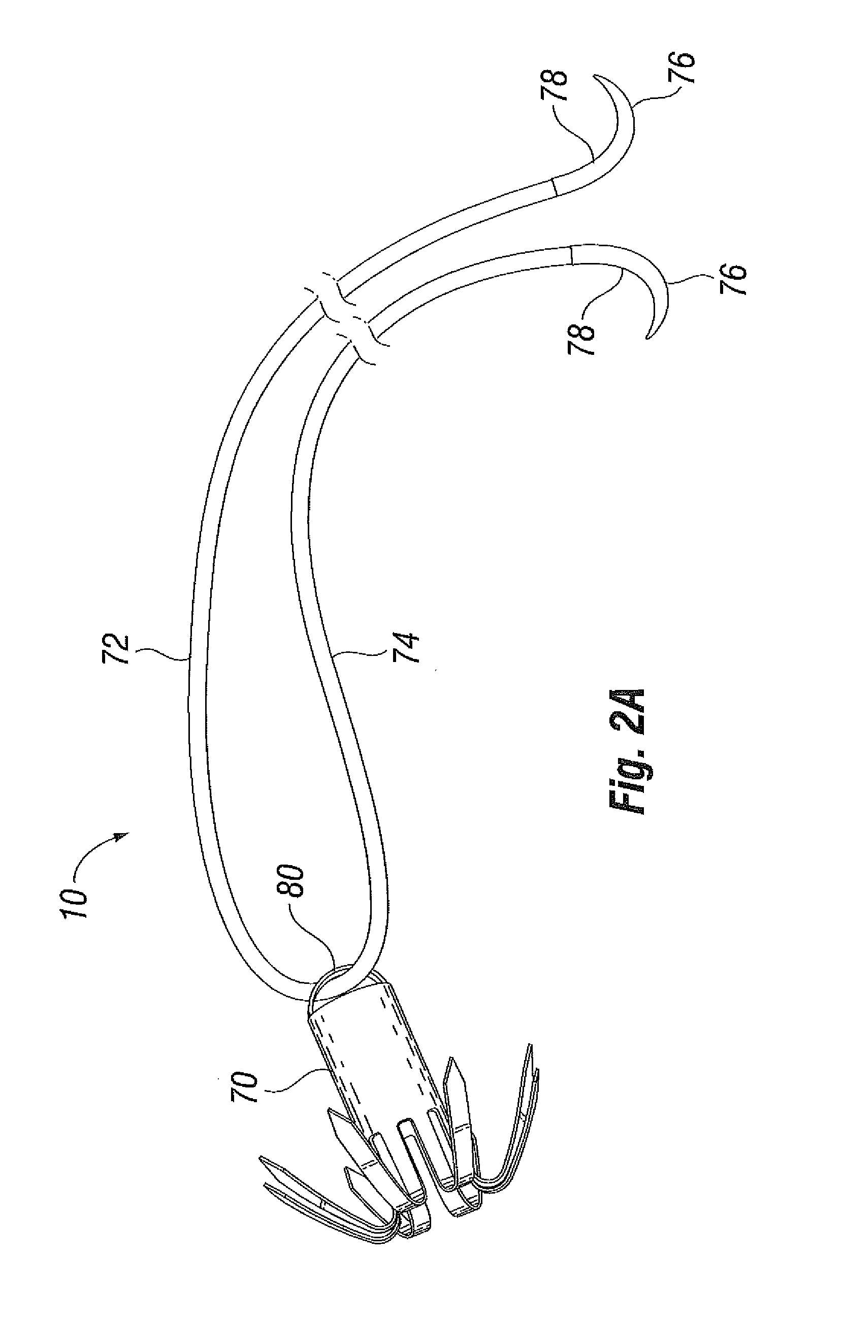 Suture and method for repairing a heart