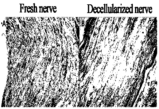 Nerve matrix catheter for nerve repair and preparation method thereof