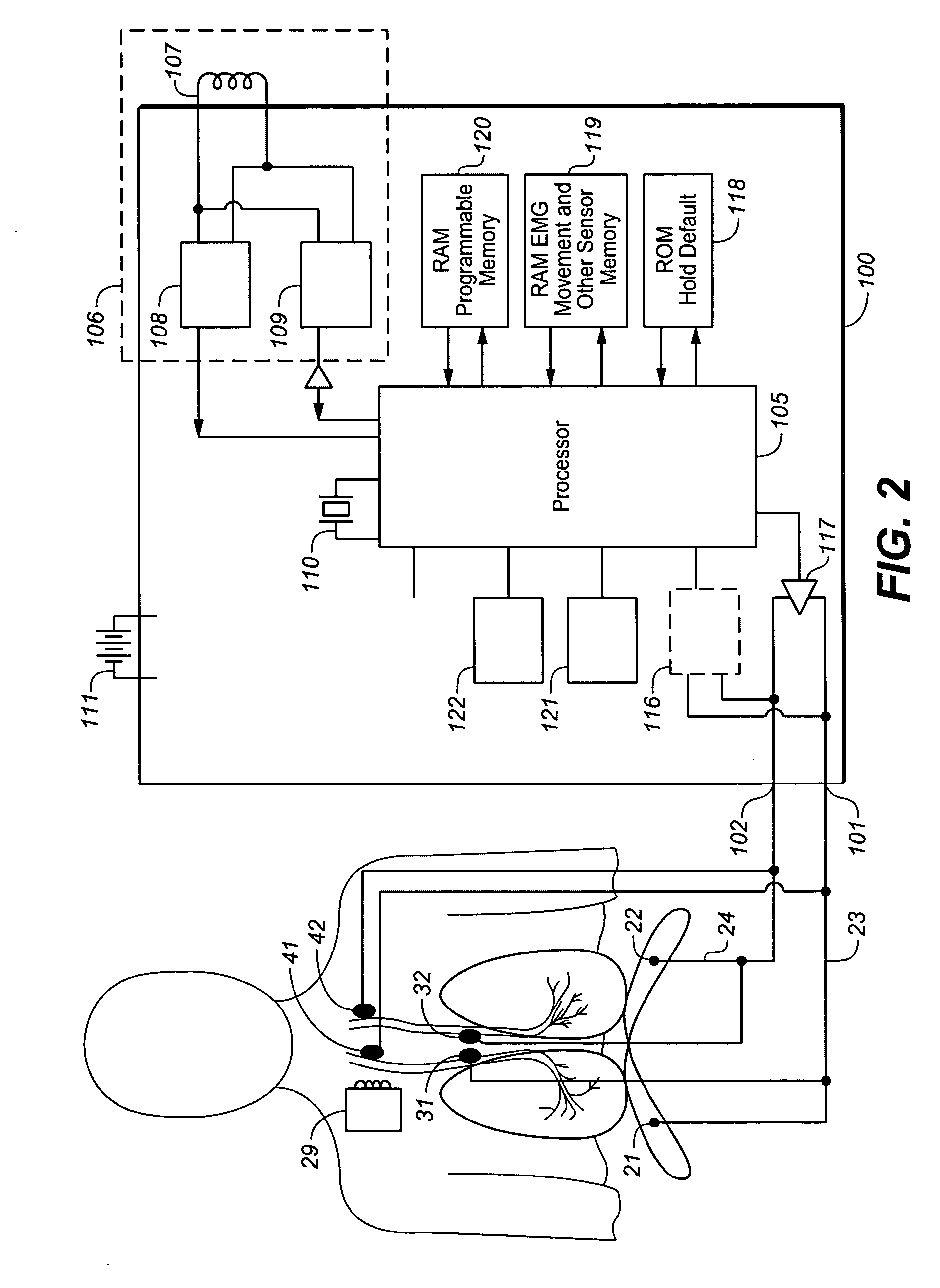 Device and method for biasing lung volume
