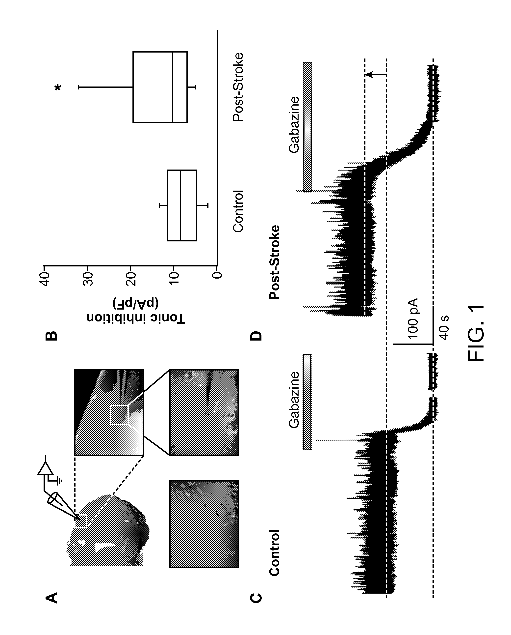 Methods and compositions for treating a subject for central nervous system (CNS) injury