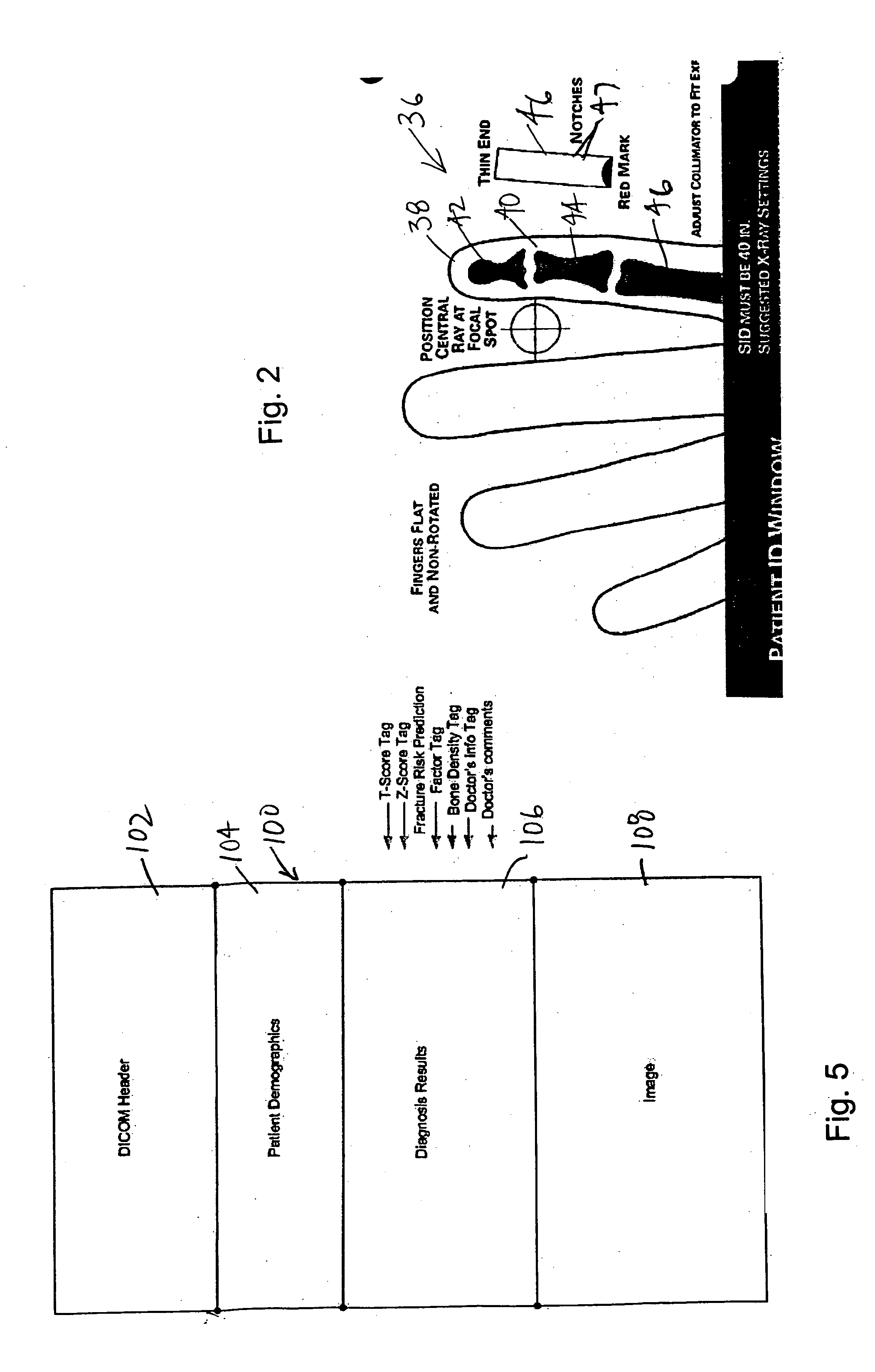 Method and system for analyzing bone conditions using DICOM compliant bone radiographic image