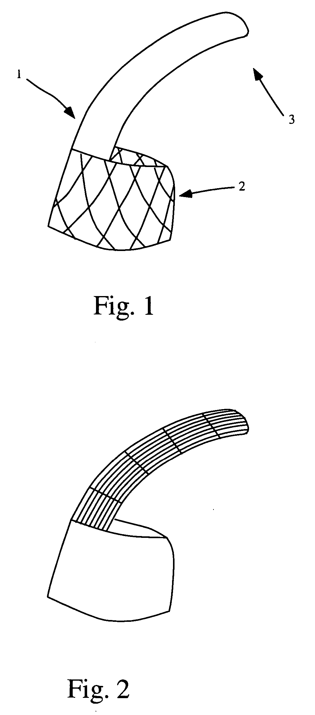 Embolic protection device for the prevention of stroke