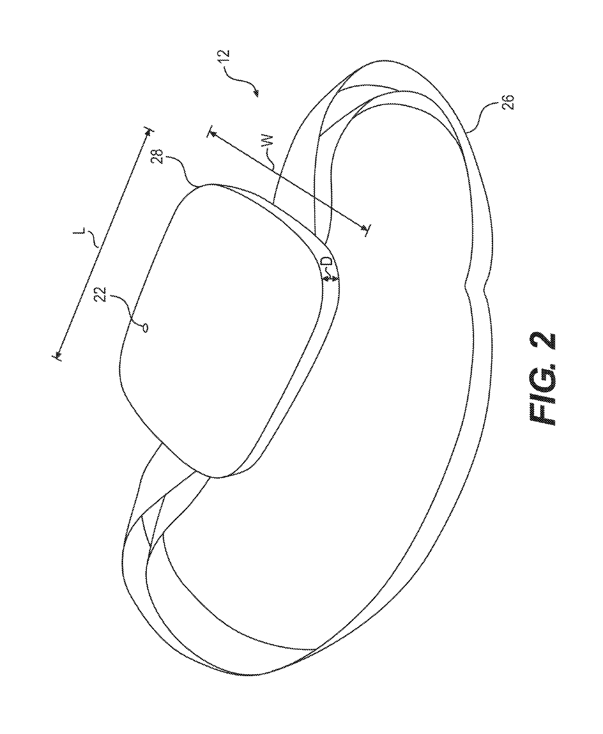 Systems and methods for medical monitoring