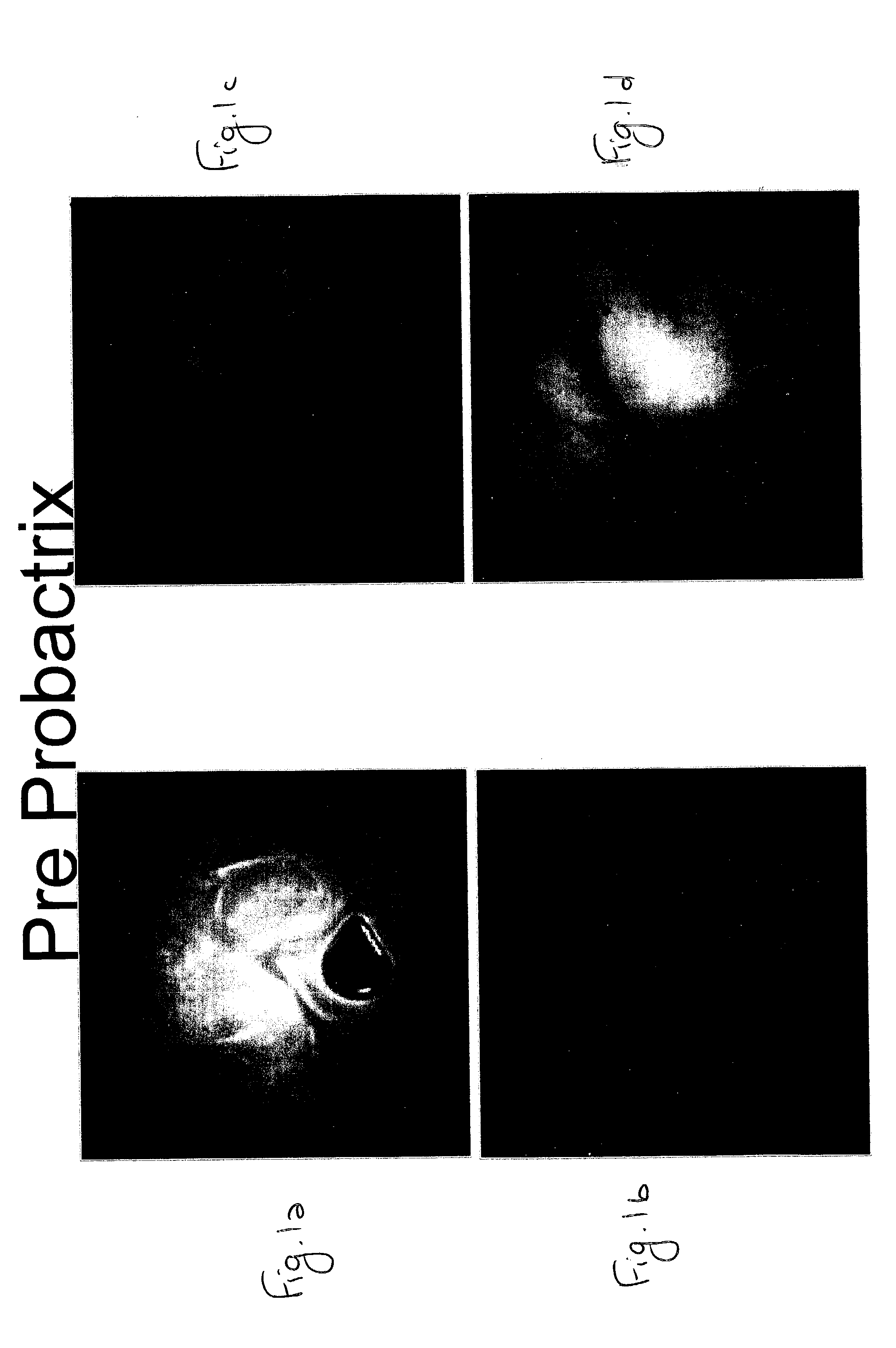 Probiotic compositions for the treatment of inflammatory bowel disease