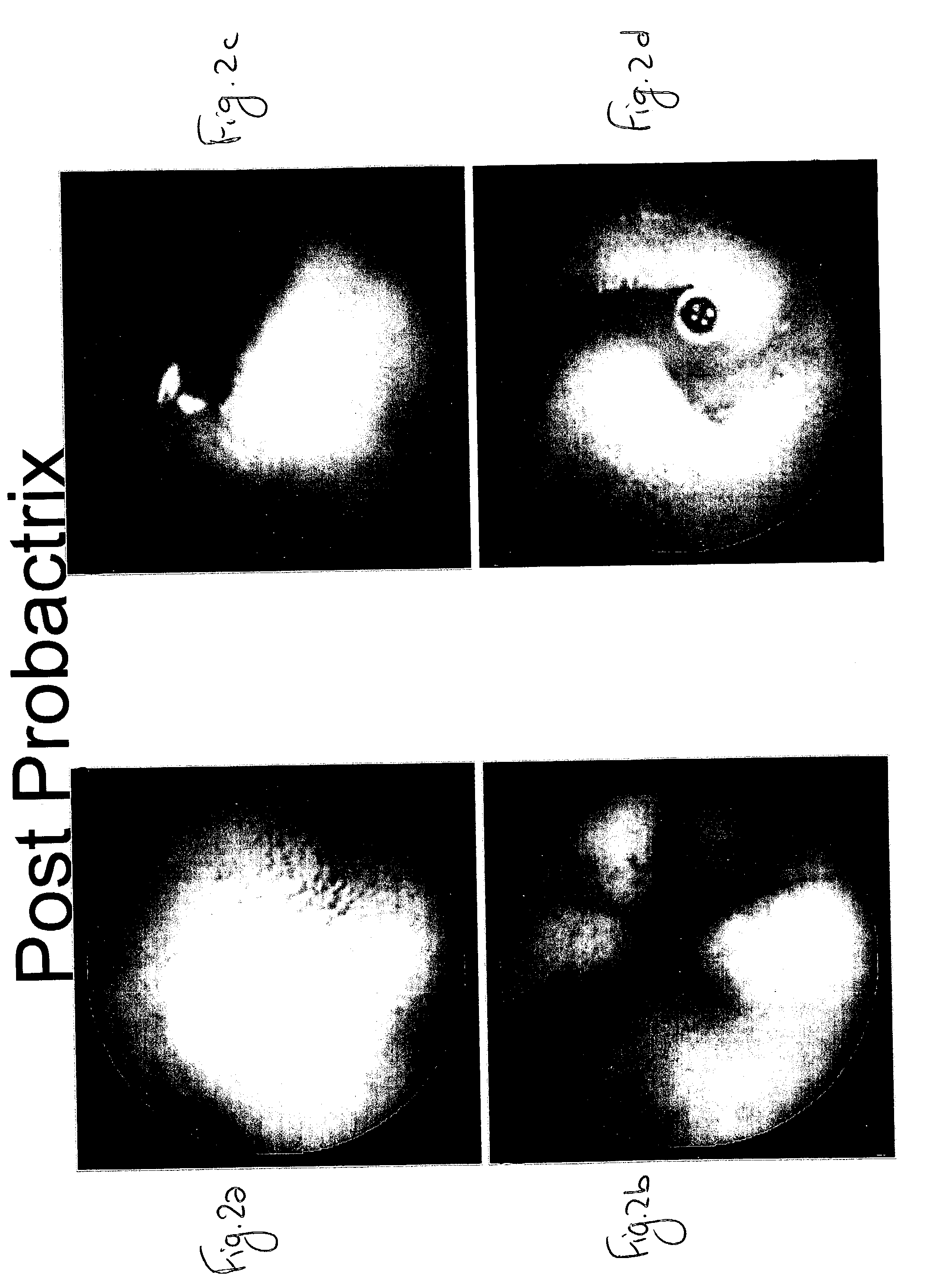 Probiotic compositions for the treatment of inflammatory bowel disease