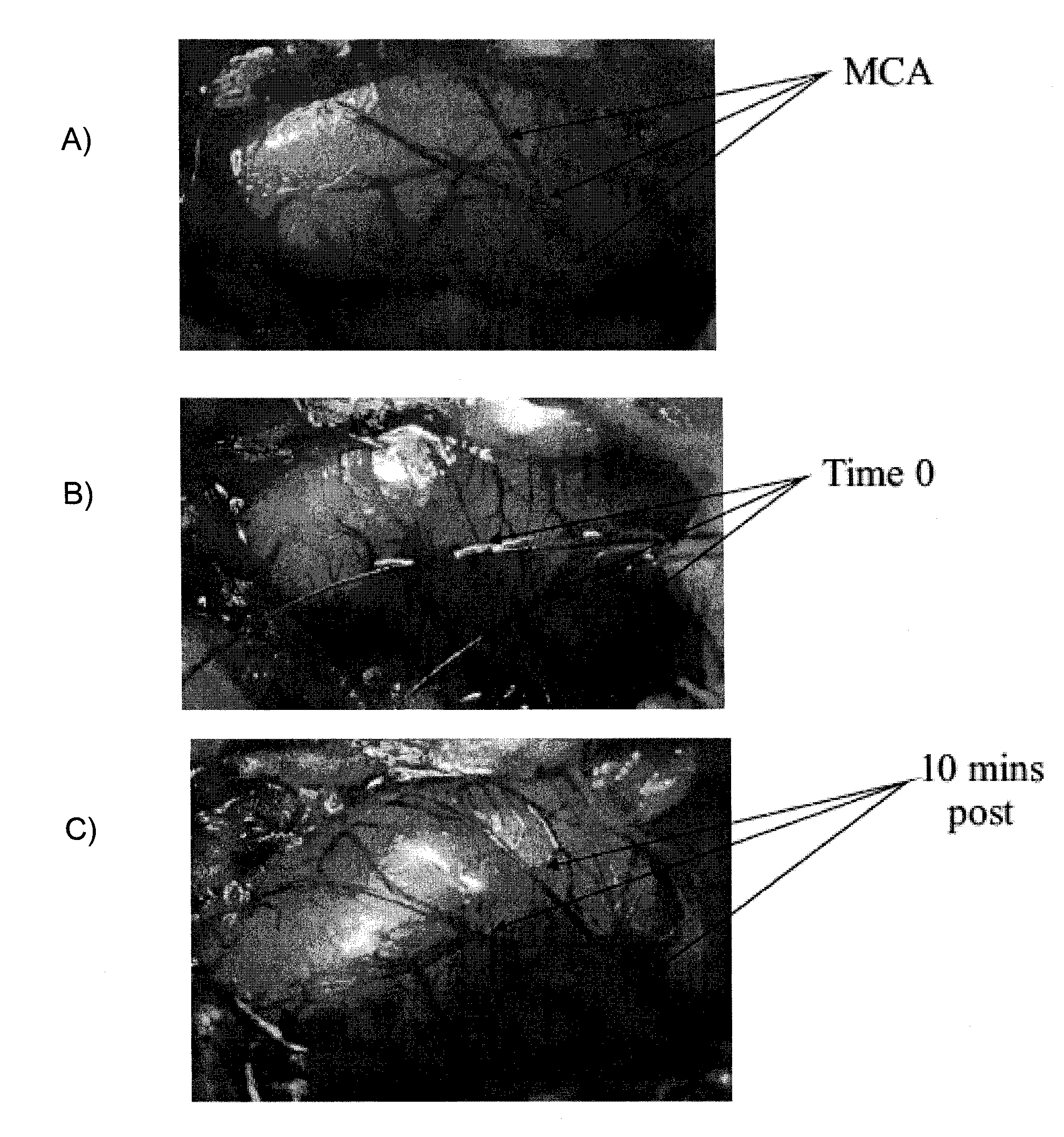 Animal stroke model