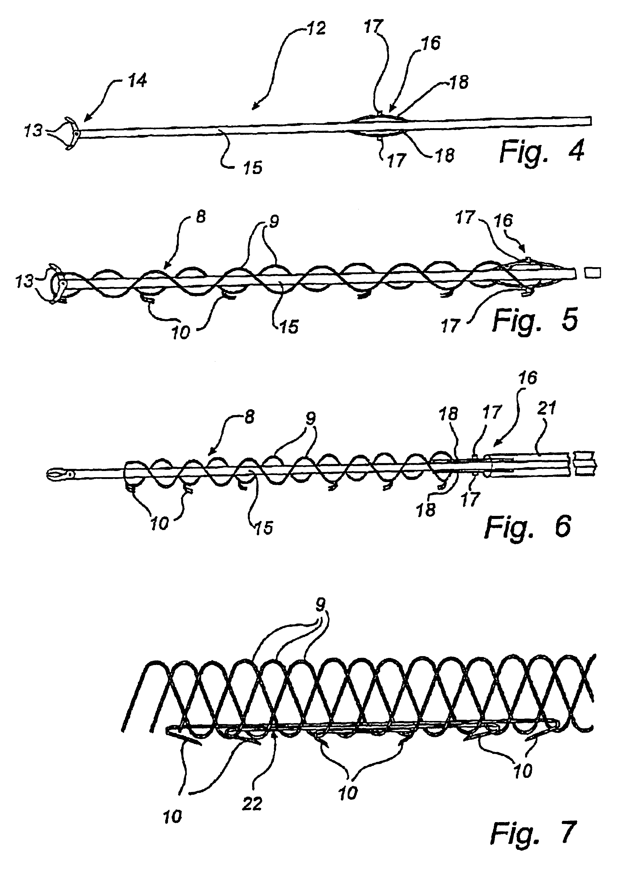 Method and device for treatment of mitral insufficiency