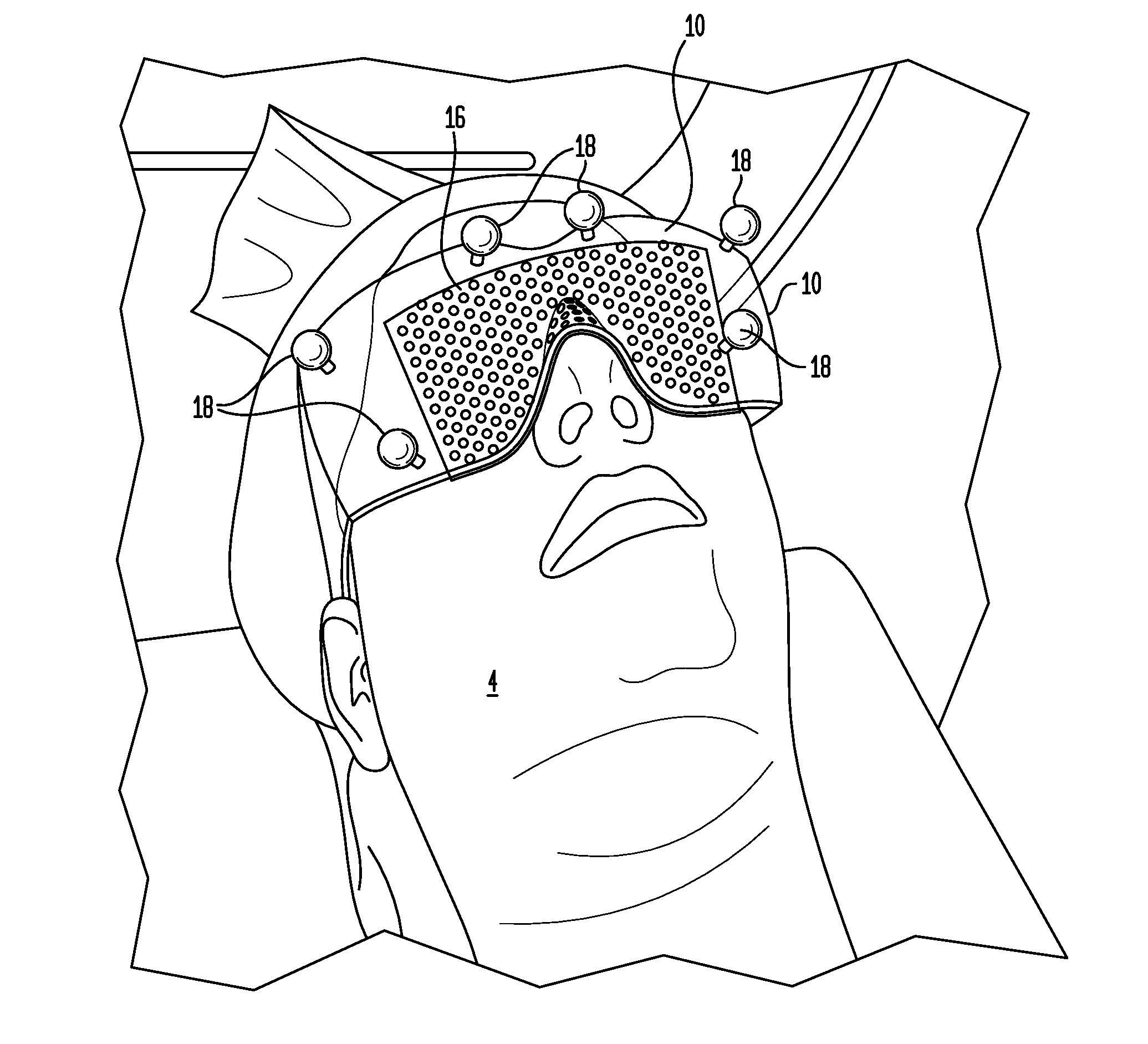 Cranial alignment device for use in intracranial stereotactic surgery