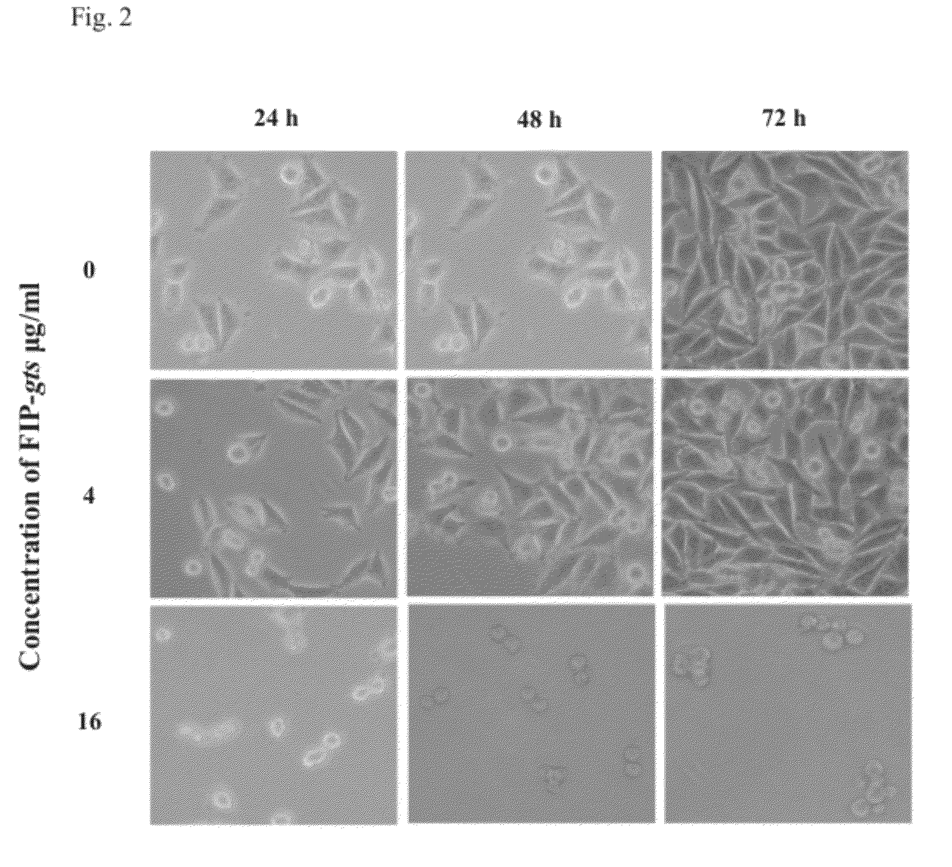 Compositions comprising fungal immunomodulatory protein and use thereof